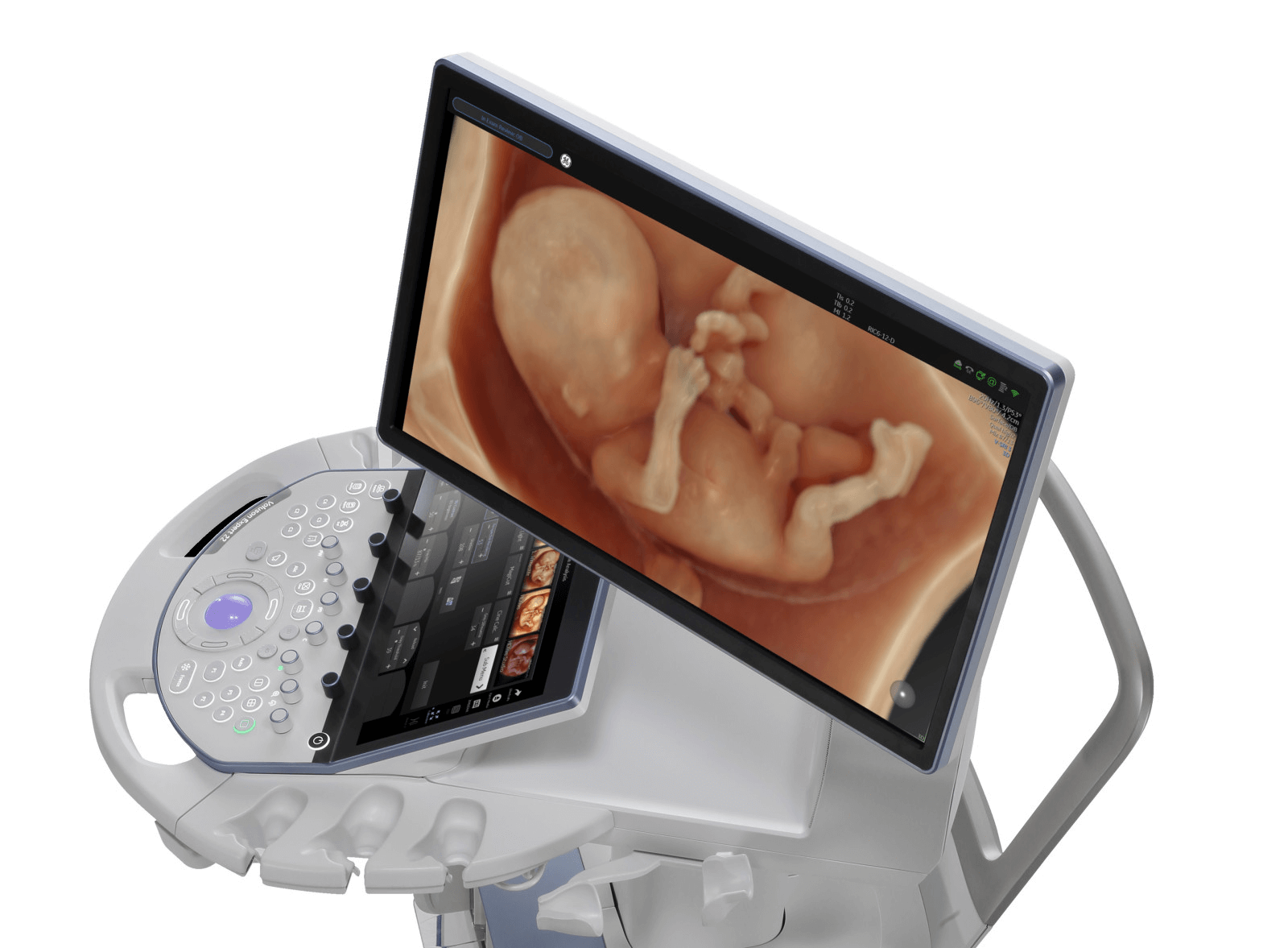 Voluson Expert 22 ultrasound machine - the most modern machine, creating a new era in fetal medicine