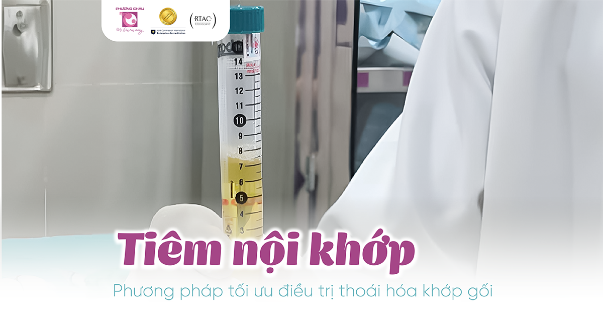Tiêm nội khớp: Phương pháp tối ưu điều trị thoái hóa khớp gối