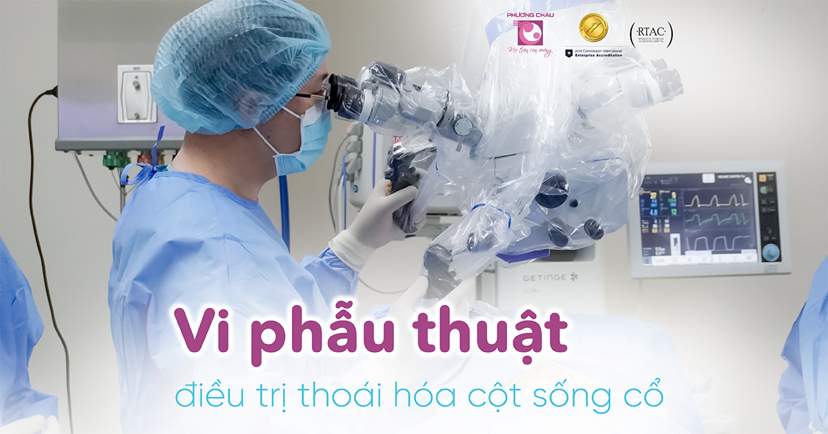 Vi phẫu thuật điều trị thoát vị đĩa đệm cột sống cổ tại Phương Châu