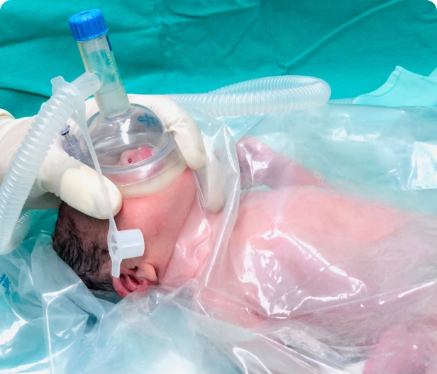 The 31-week-old boy was born strong, and together with his mother, he survived a dangerous striker surgery