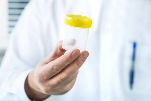 Tinh dịch loãng là gì? Nguyên nhân và cách điều trị