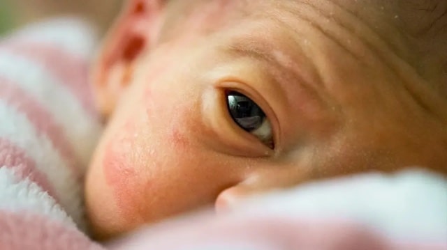 Các vấn đề của trẻ sinh non trước và sau xuất viện cần theo dõi