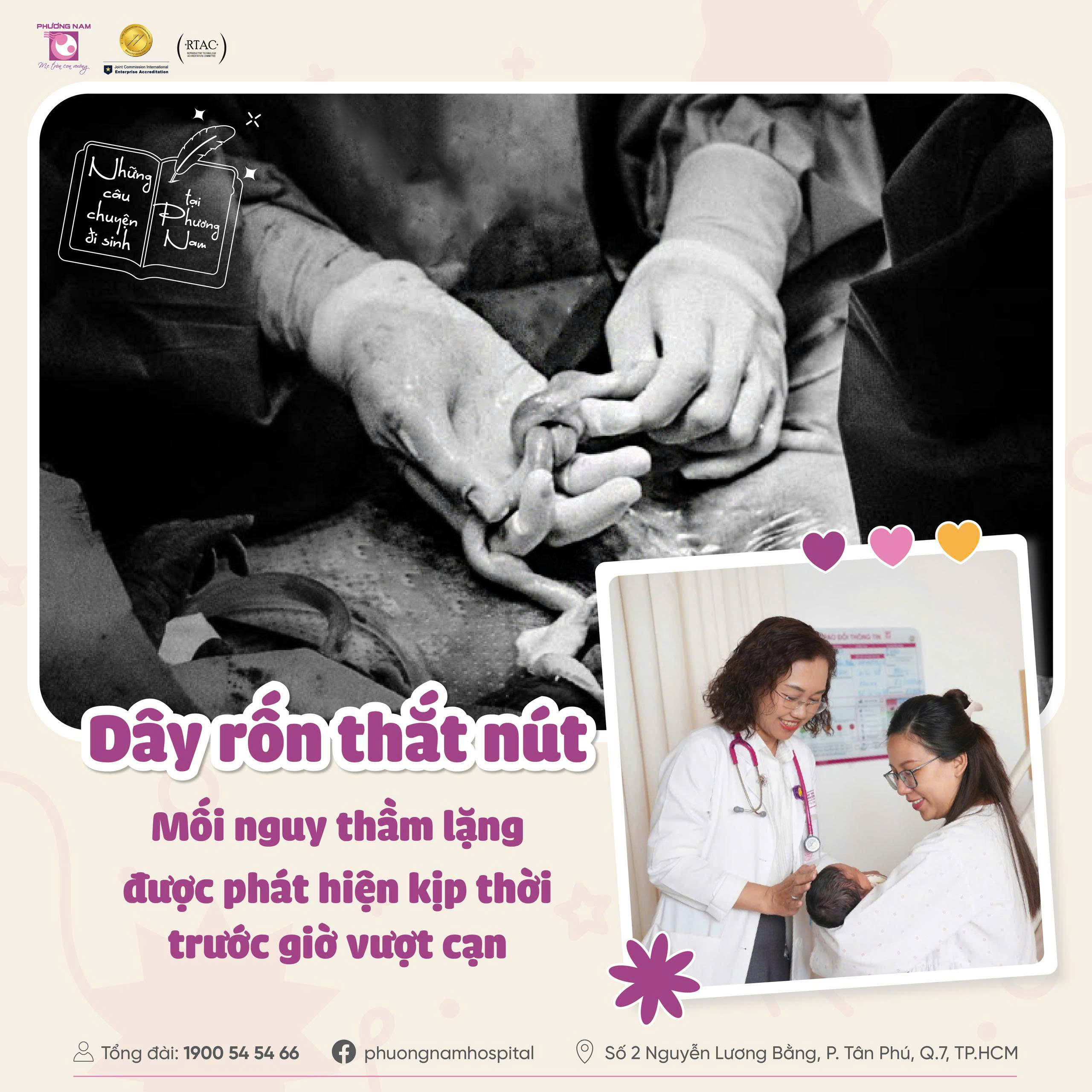 Dây rốn thắt nút: Nguy cơ thầm lặng được phát hiện trước sinh