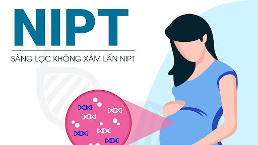 Khám sàng lọc NIPT là gì và những điều mẹ cần biết?