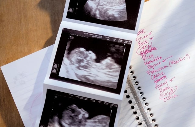 Các mốc siêu âm thai mẹ bầu không nên bỏ qua