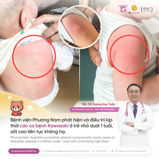 Bệnh viện Phương Nam chẩn đoán và điều trị thành công các ca bệnh Kawasaki nguy hiểm ở trẻ nhỏ dưới 1 tuổi