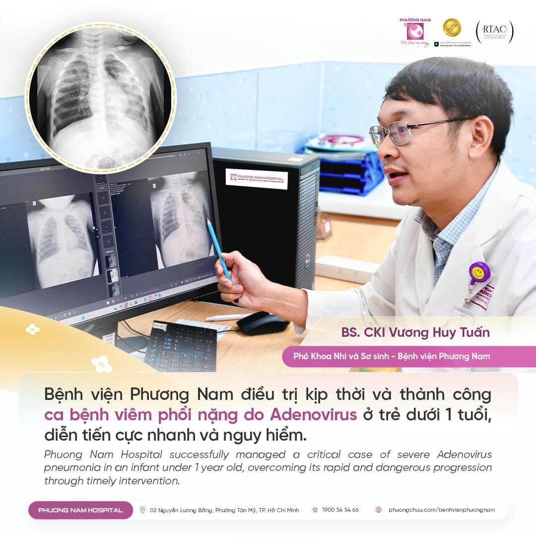 Cảnh báo viêm phổi diễn tiến nhanh và nguy hiểm do adenovirus ở trẻ em