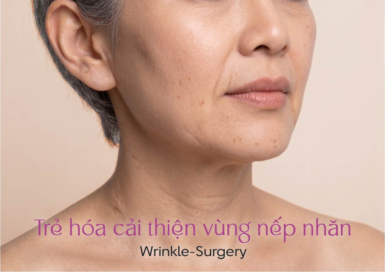 Trẻ hóa cái thiện vùng nếp nhăn