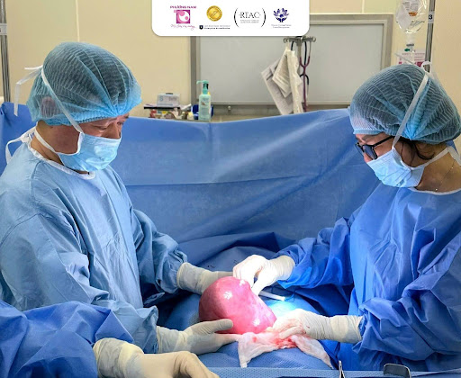 7 năm rong kinh, tử cung to như thai 6 tháng: Bài học từ ca u xơ dẫn đến biến chứng thiếu máu nặng