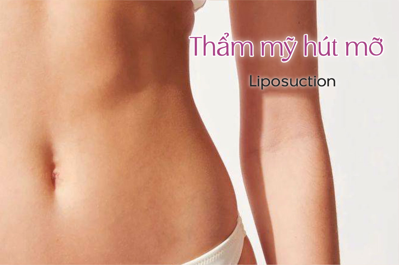 ✽ Thẩm mỹ hút mỡ