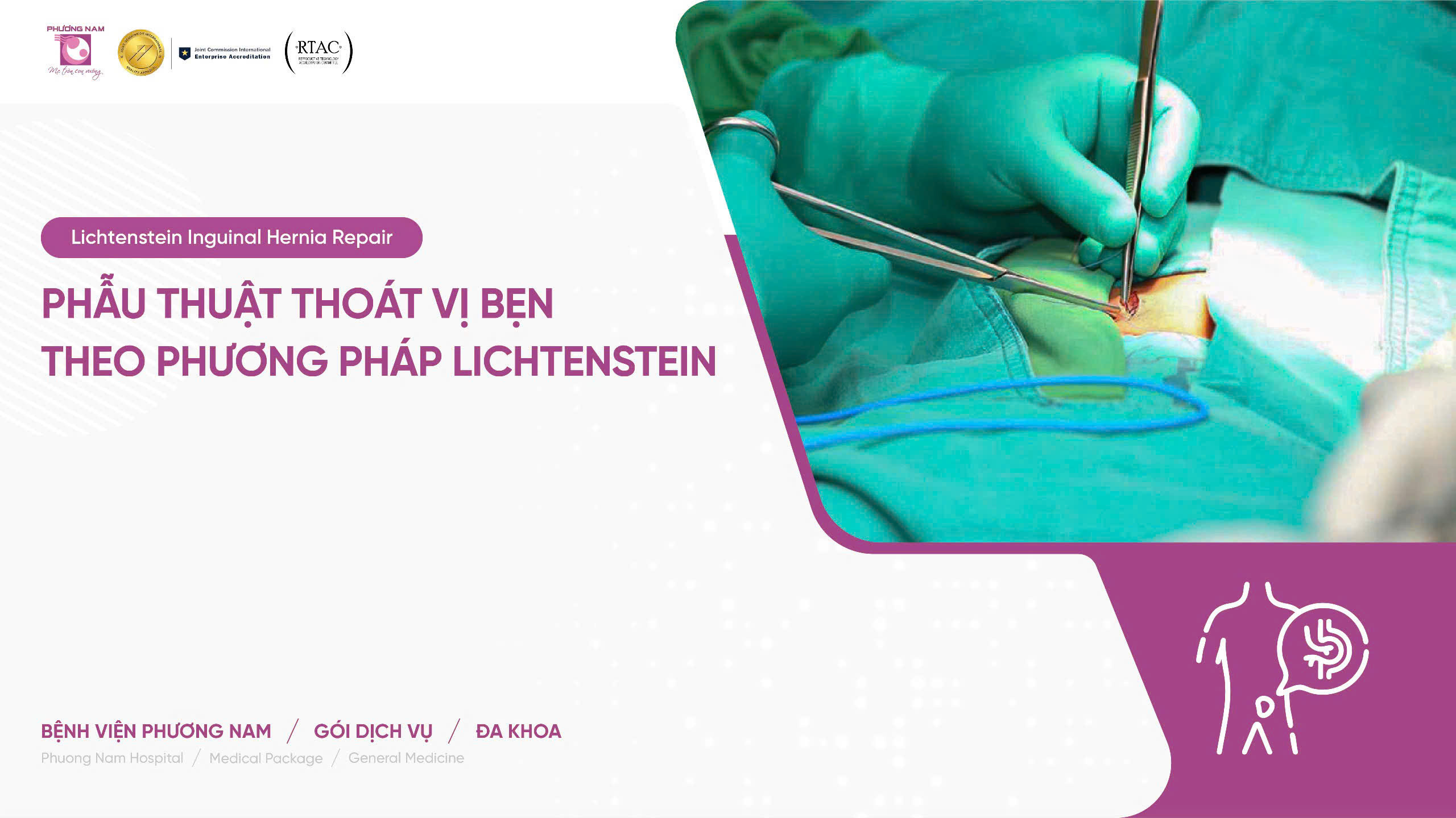 Phẫu thuật ngoại khoa - thoát vị bẹn