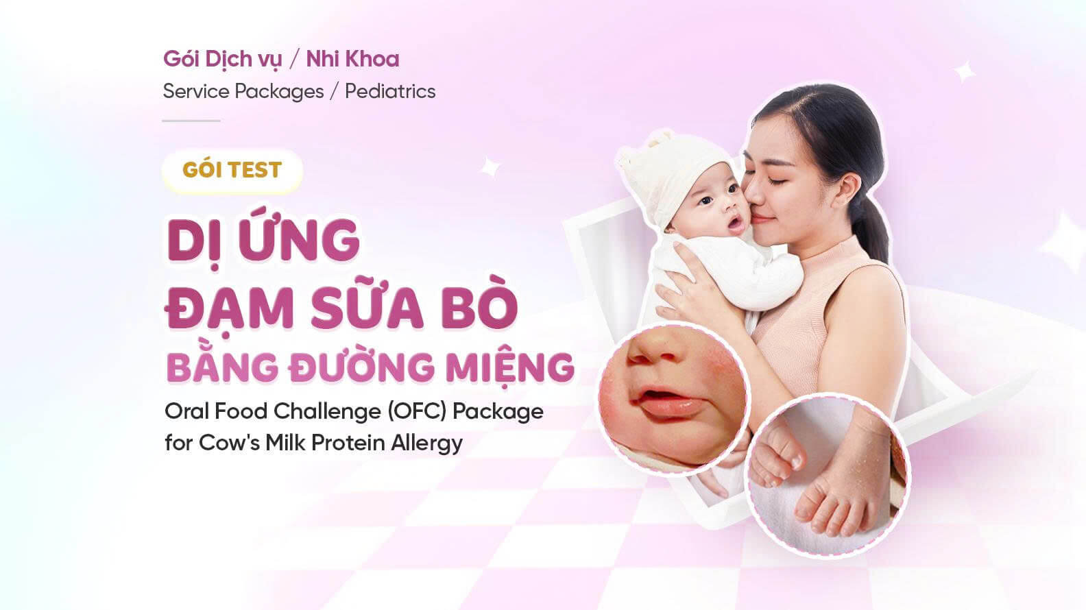 Gói Test dị ứng đạm sữa bò qua đường miệng