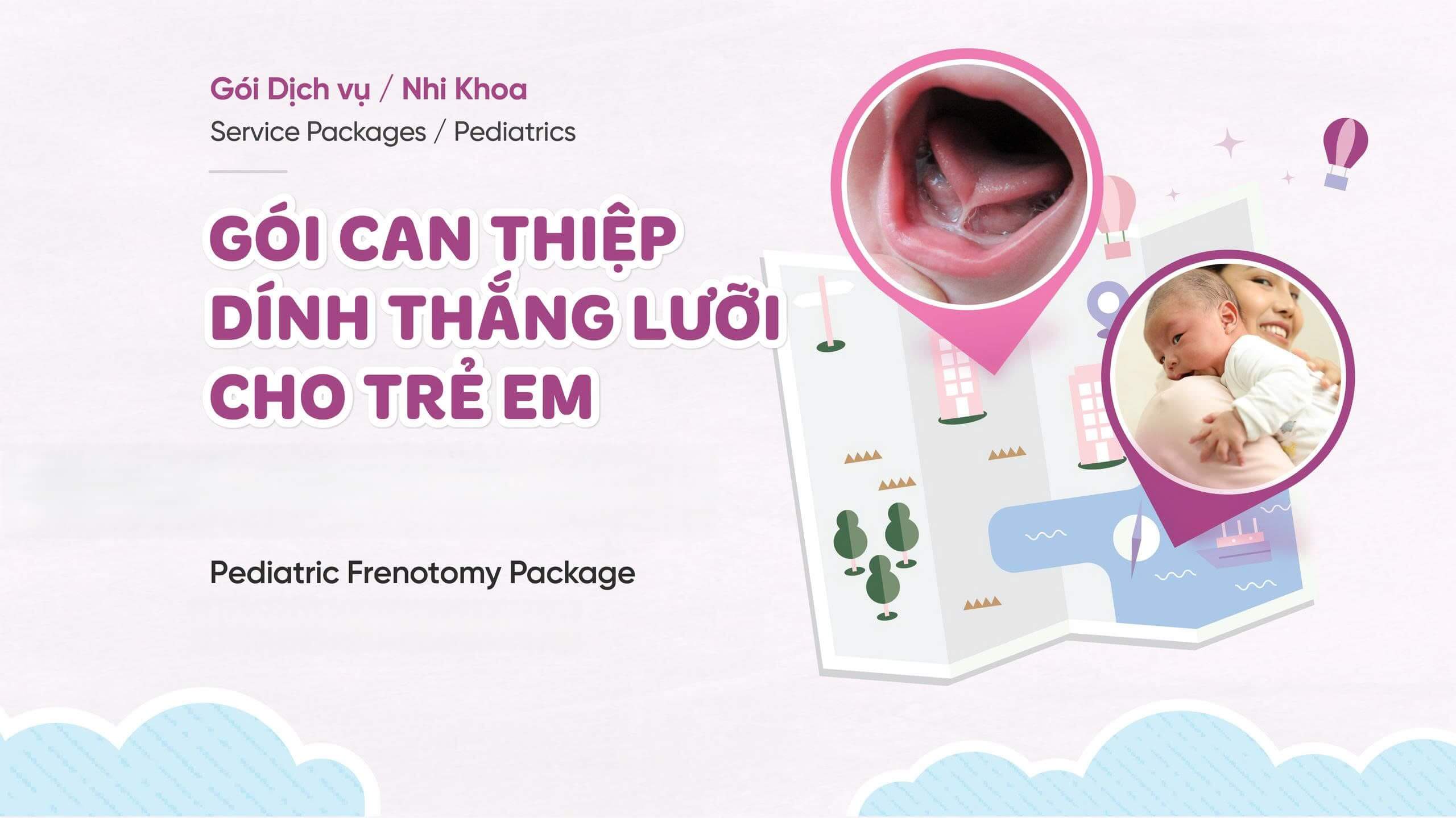 Dịch vụ can thiệp thắng lưỡi trẻ em