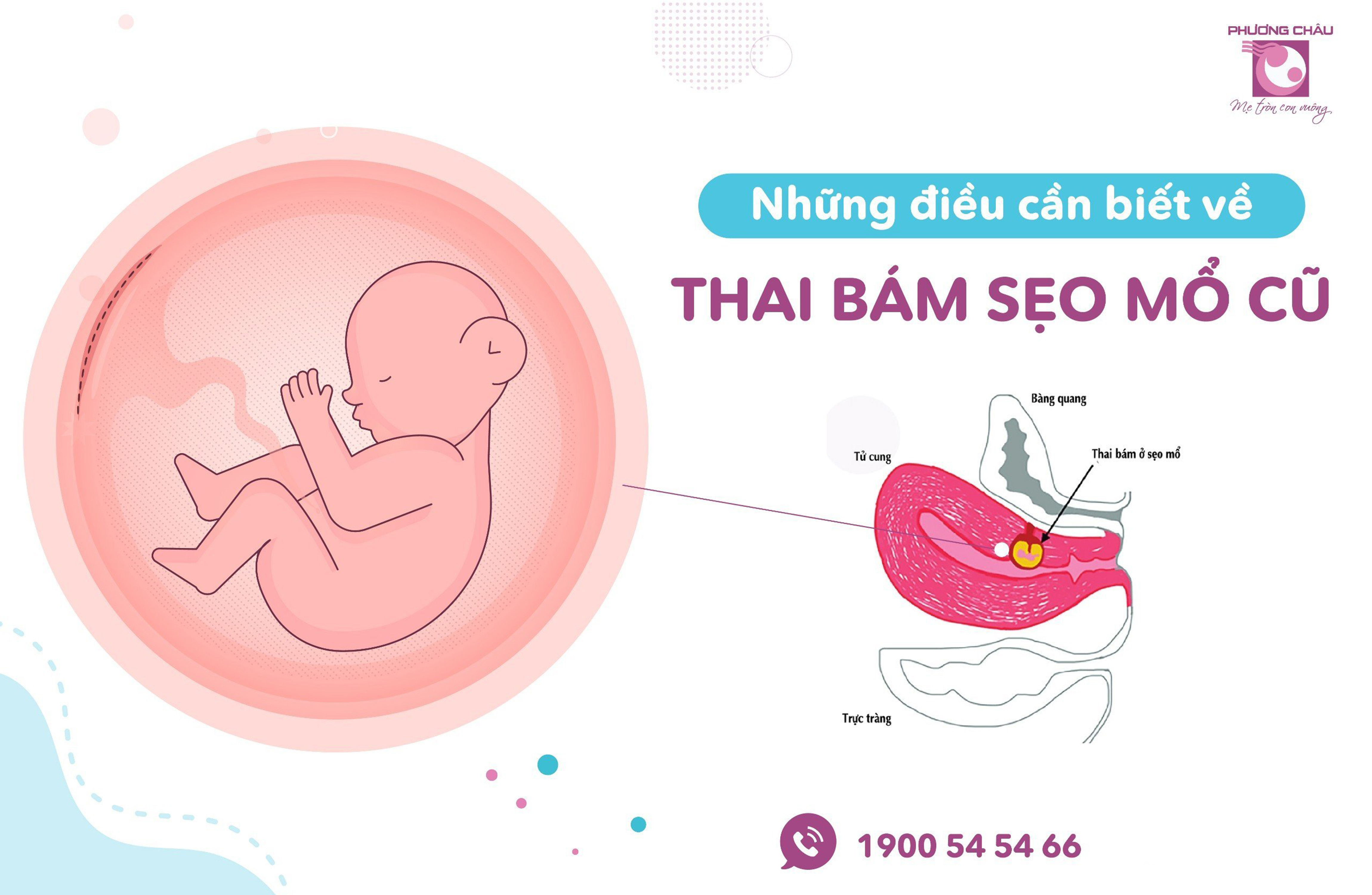 Mơ Bệnh Viện Đánh Con Gì - Giải Mã Ý Nghĩa Và Con Số May Mắn