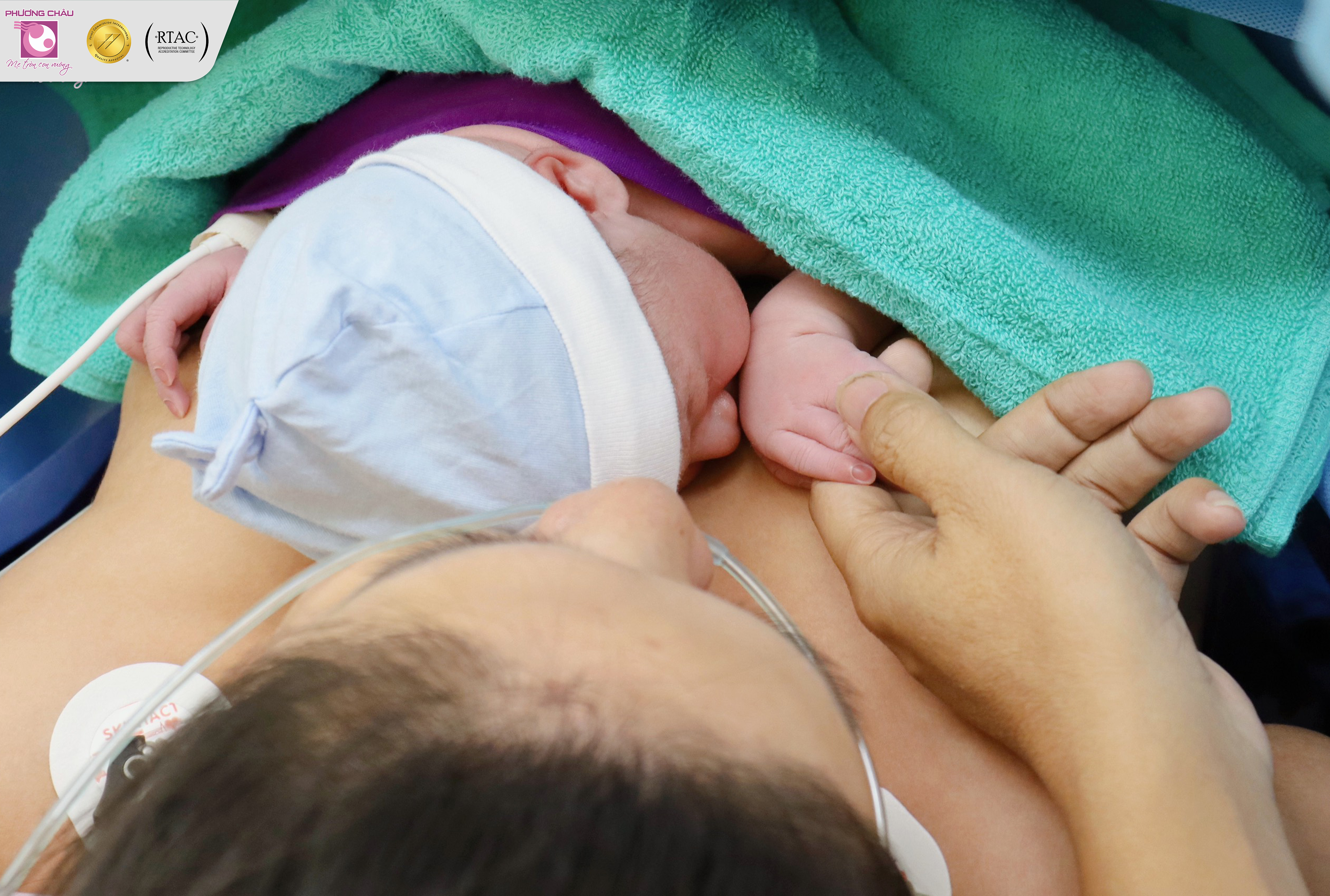 DA KỀ DA NGAY SAU SINH & NHỮNG ĐIỀU “KỲ DIỆU” MANG LẠI CHO HAI MẸ CON