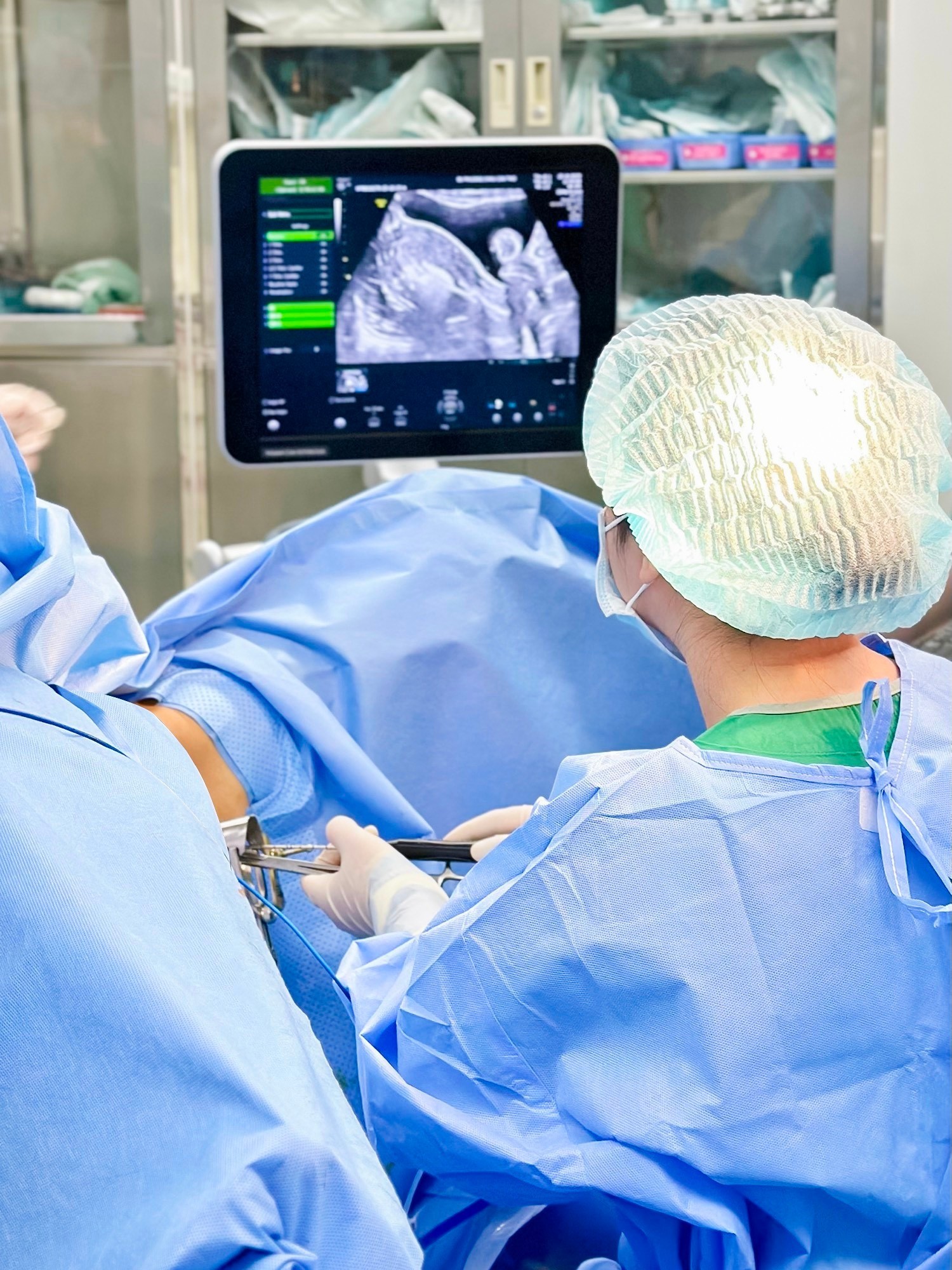 ĐỐT LẠC NỘI MẠC TRONG CƠ TỬ CUNG (ADENOMYOSIS) BẰNG SÓNG CAO TẦN (RFA)