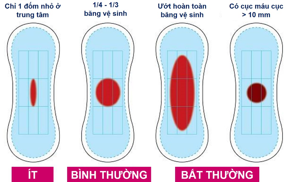 NGUYÊN NHÂN GÂY XUẤT HUYẾT TỬ CUNG BẤT THƯỜNG