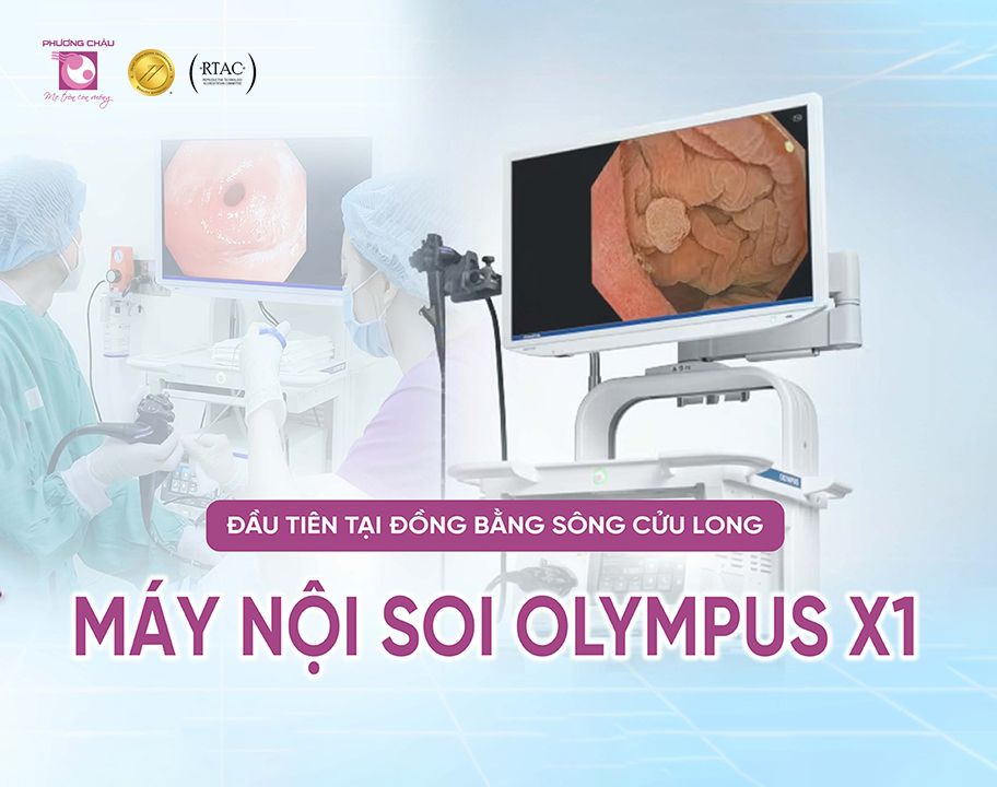 Những công nghệ trên máy nội soi OLYMPUS X1 hiện đại nhất hiện nay