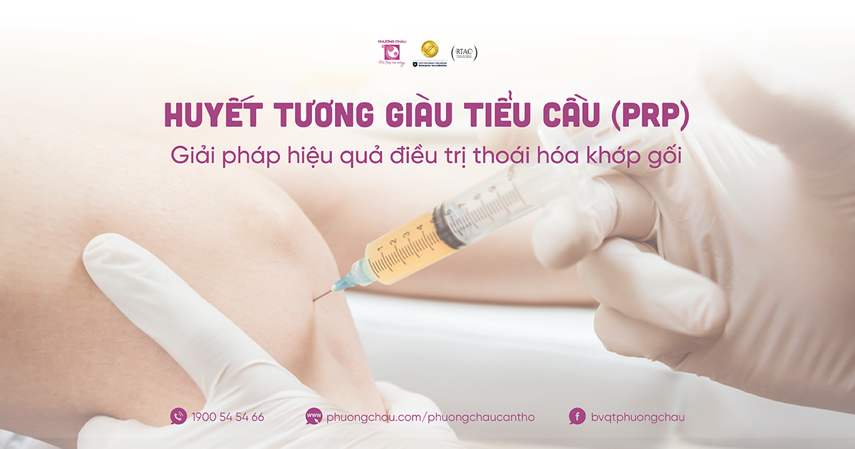 Huyết tương giàu tiểu cầu (PRP) điều trị hiệu quả thoái hóa khớp