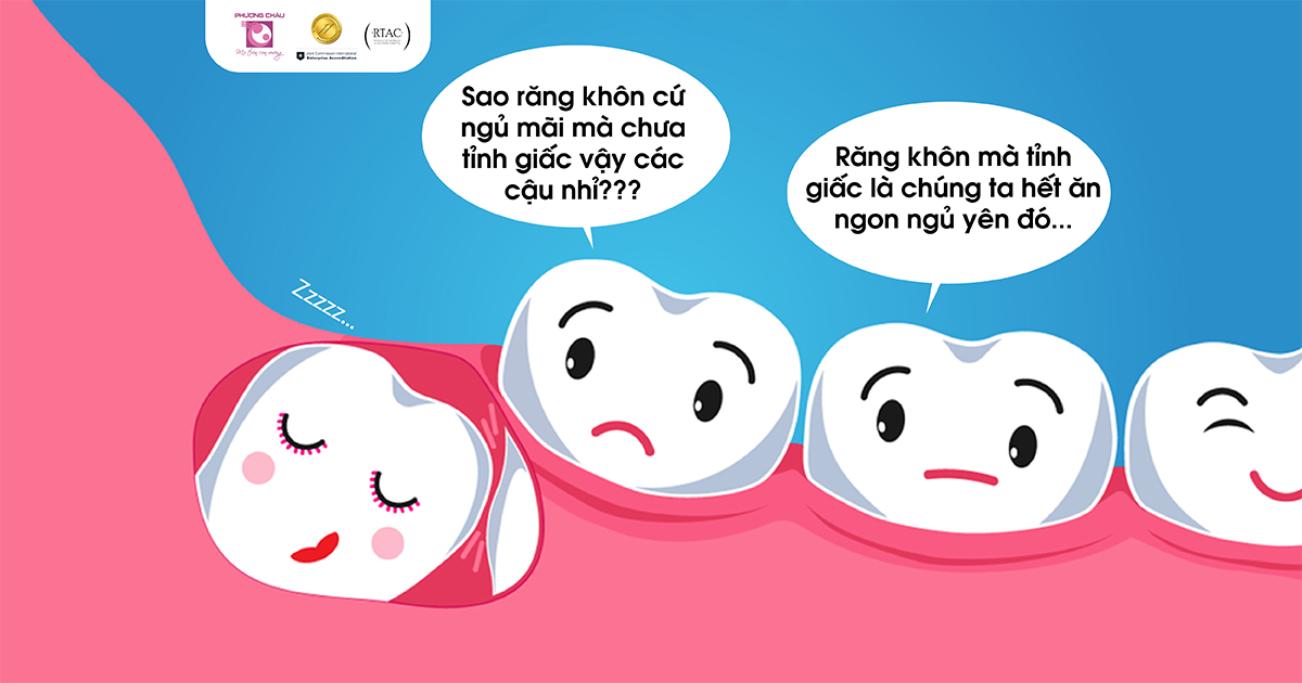 Răng khôn: Những điều cần biết trước khi quyết định nhổ