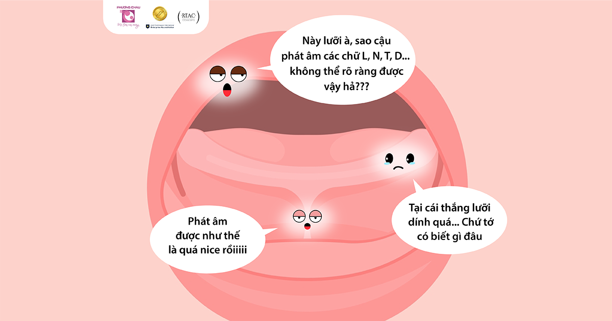Dính thắng lưỡi là gì? Những điều ba mẹ không nên bỏ qua