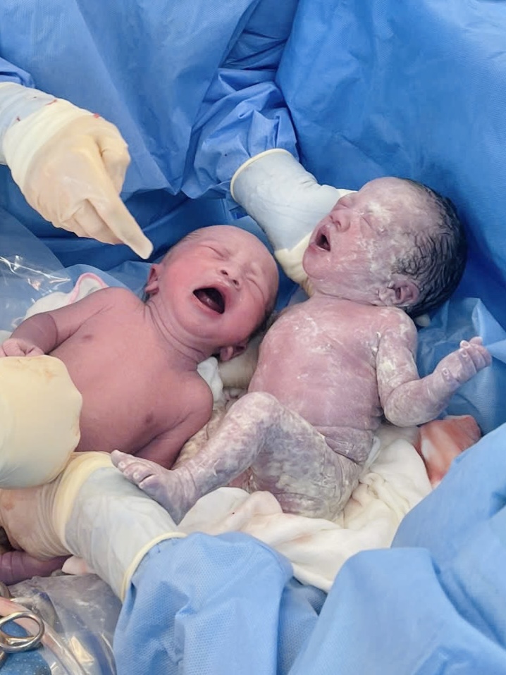 Hội Chứng Siêu Nữ (XXX): Rối Loạn Di Truyền Hiếm Gặp Được Phát Hiện Sớm Nhờ Tầm Soát Trước Sinh