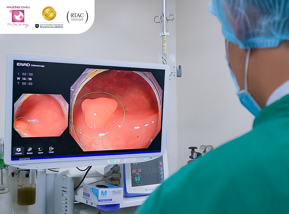 Nội soi có sự hỗ trợ của trí tuệ nhân tạo: Bước đột phá mới trong y học tiêu hóa