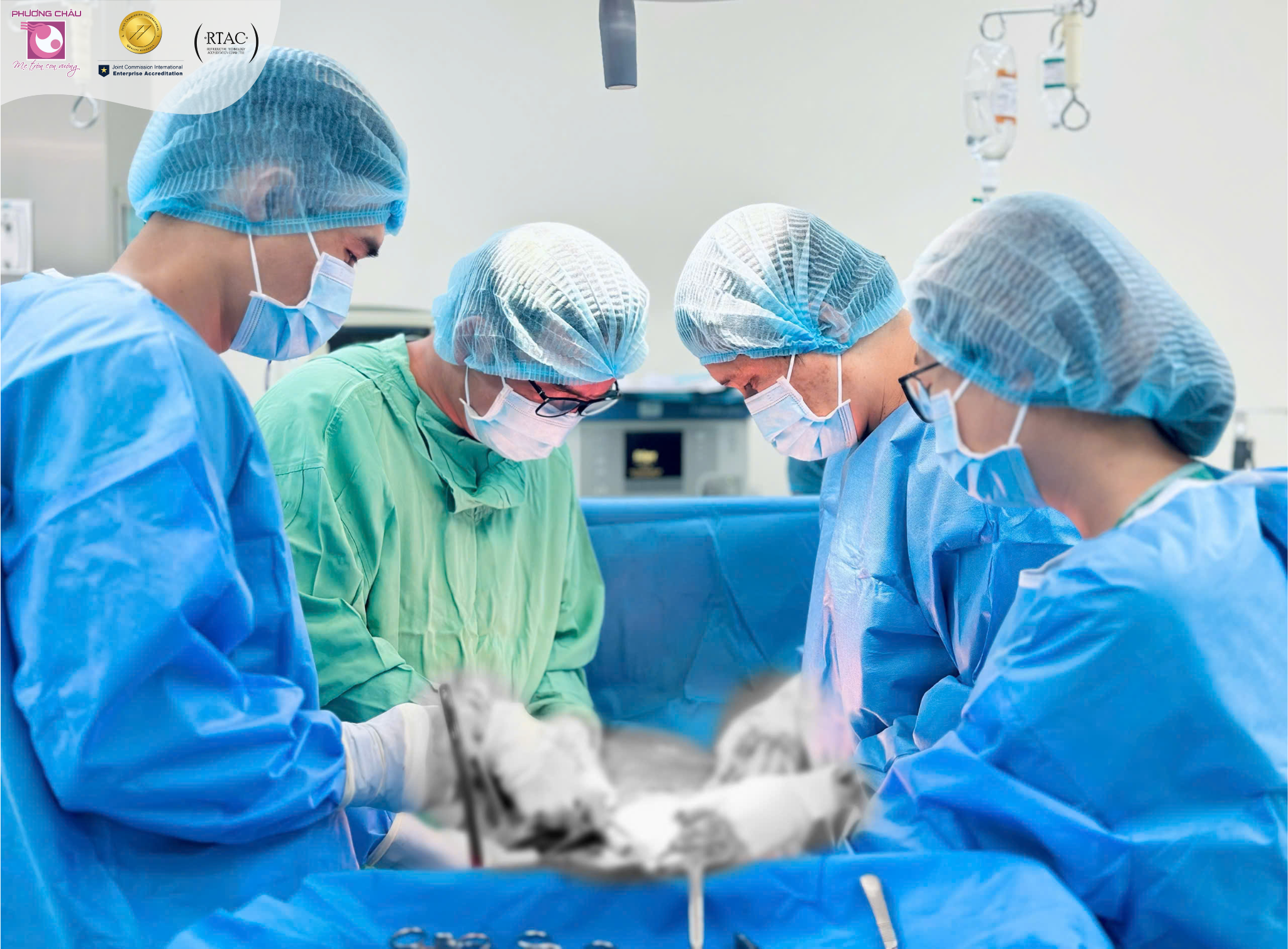 HƠN 10 NĂM KHÔNG KHÁM PHỤ KHOA VÀ PHÁT HIỆN KHỐI U XƠ TO BẰNG NẮM TAY