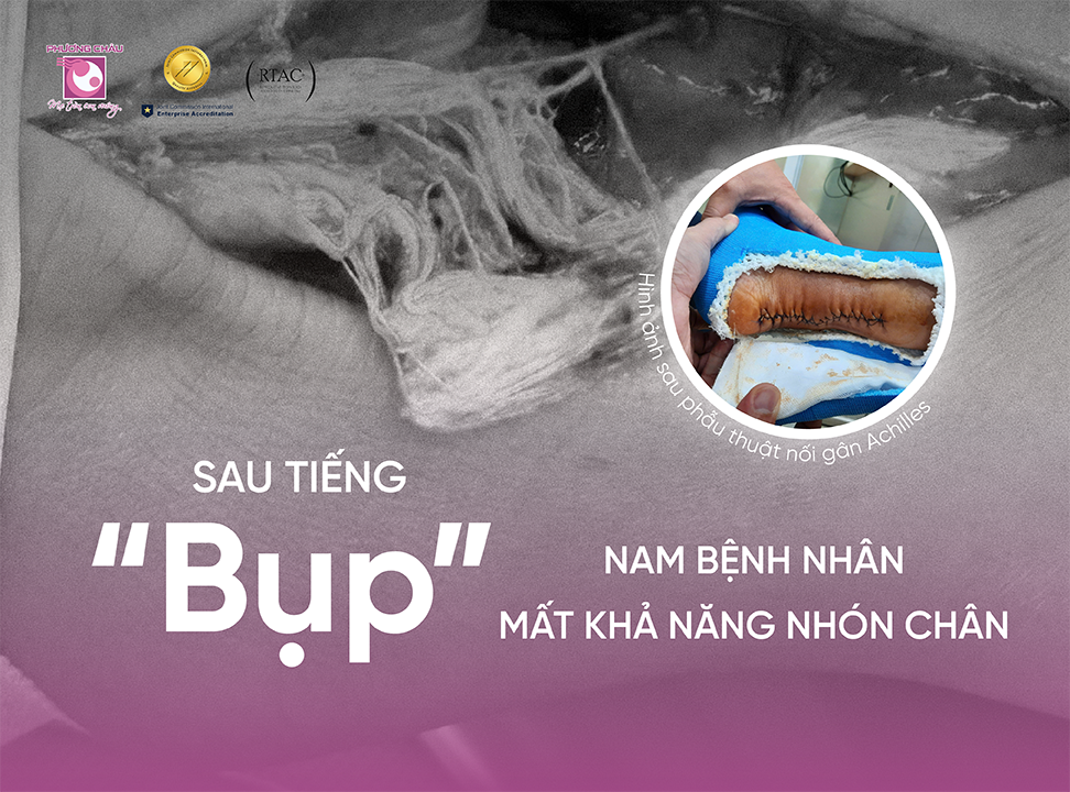 Không nên xem nhẹ các chấn thương do chơi thể thao
