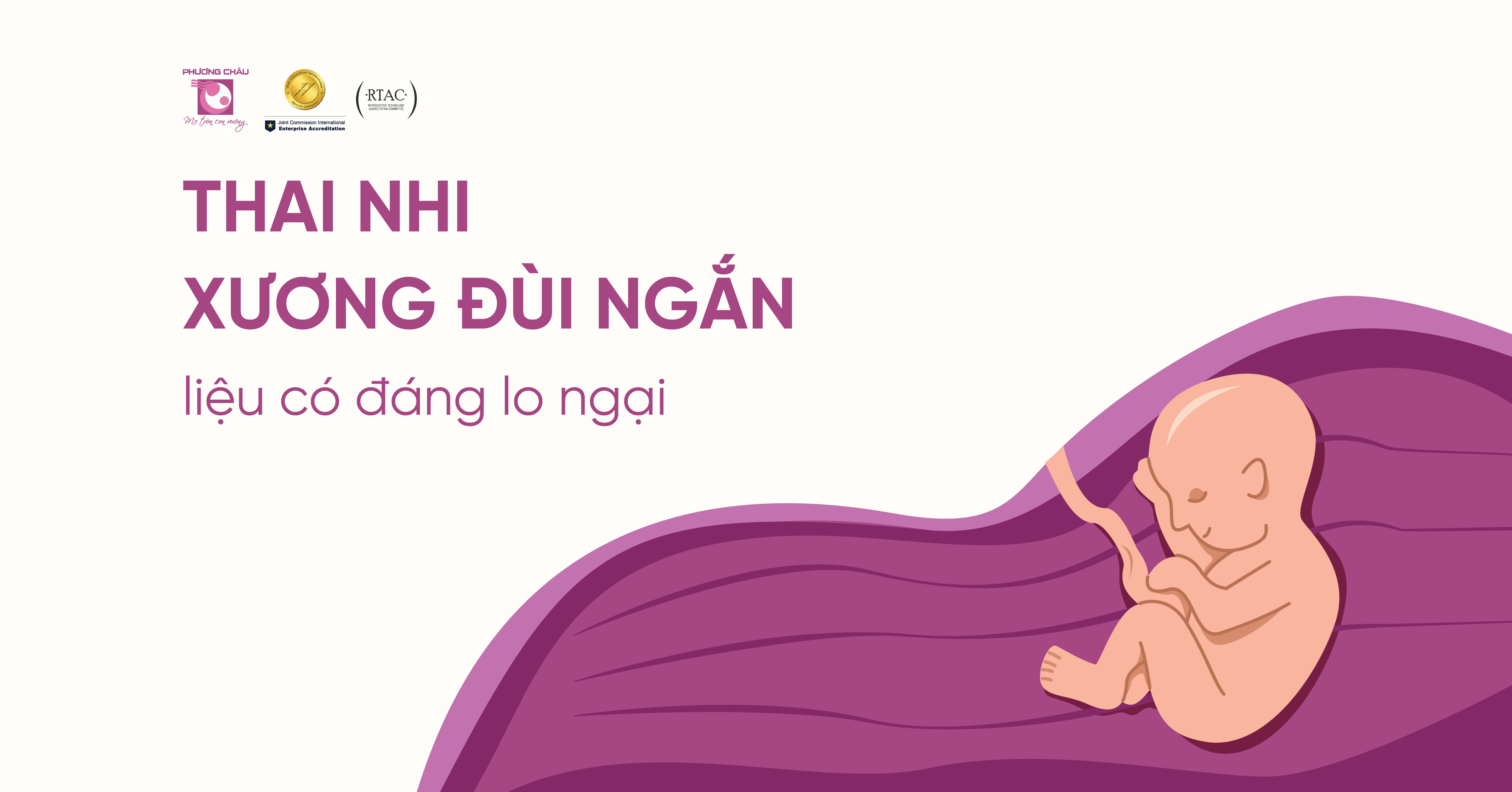 Thai nhi xương đùi ngắn - có đáng lo ngại?