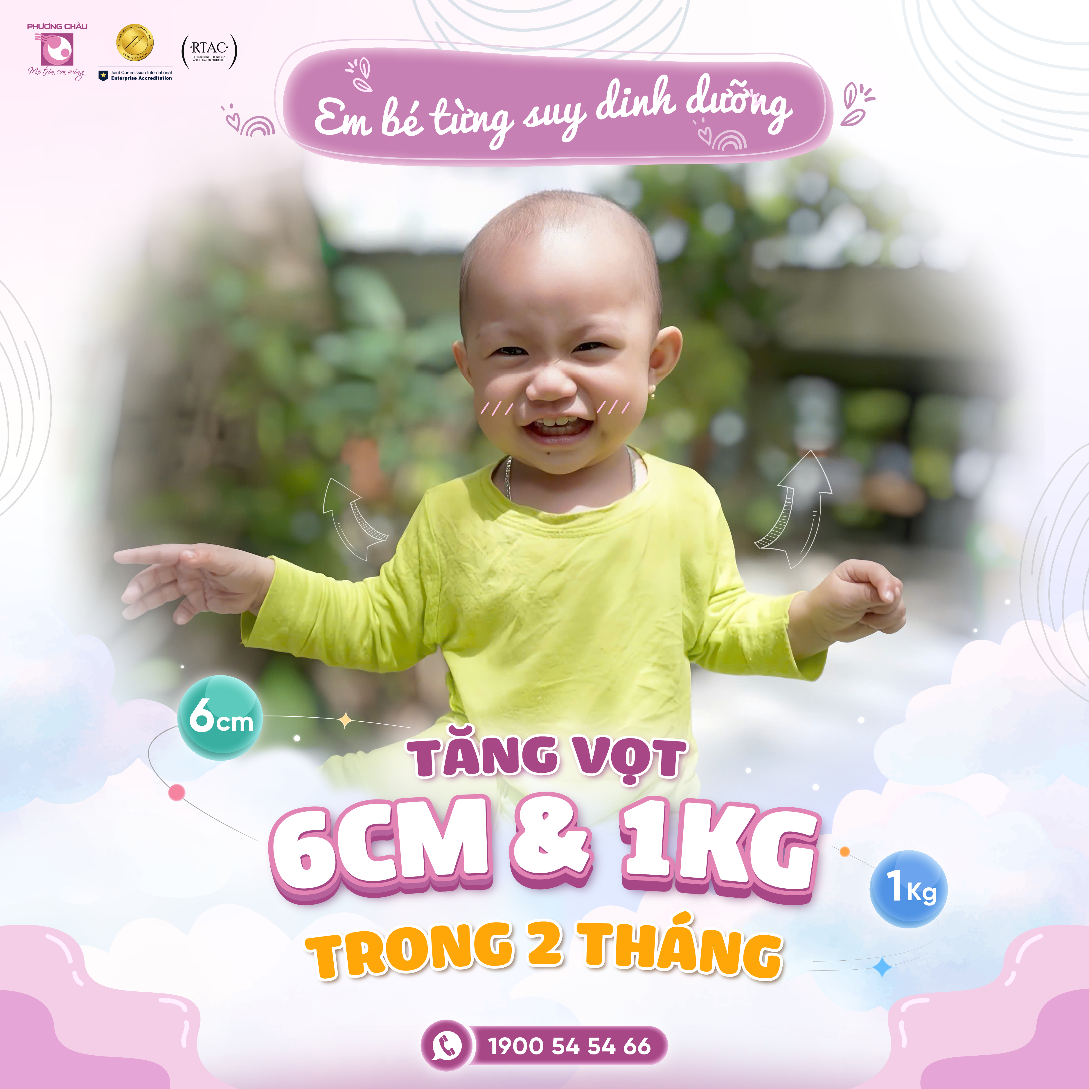 EM BÉ CAO VỌT LÊN ĐẾN 6CM SAU 2 THÁNG