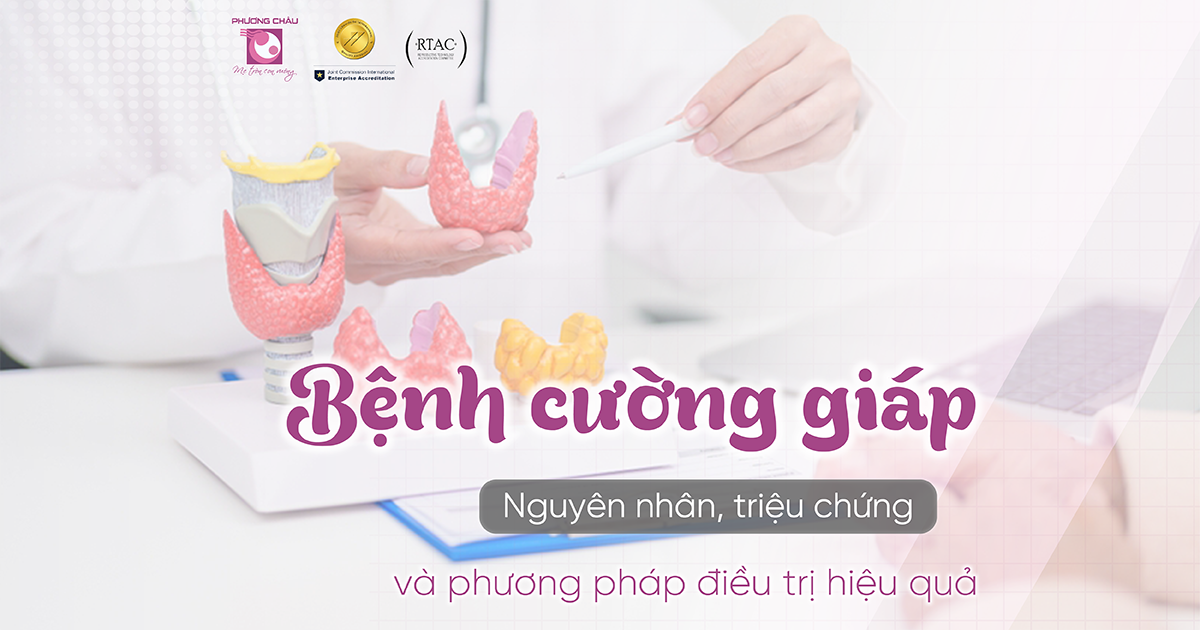 Bệnh cường giáp: Nguyên nhân, triệu chứng và cách điều trị hiệu quả
