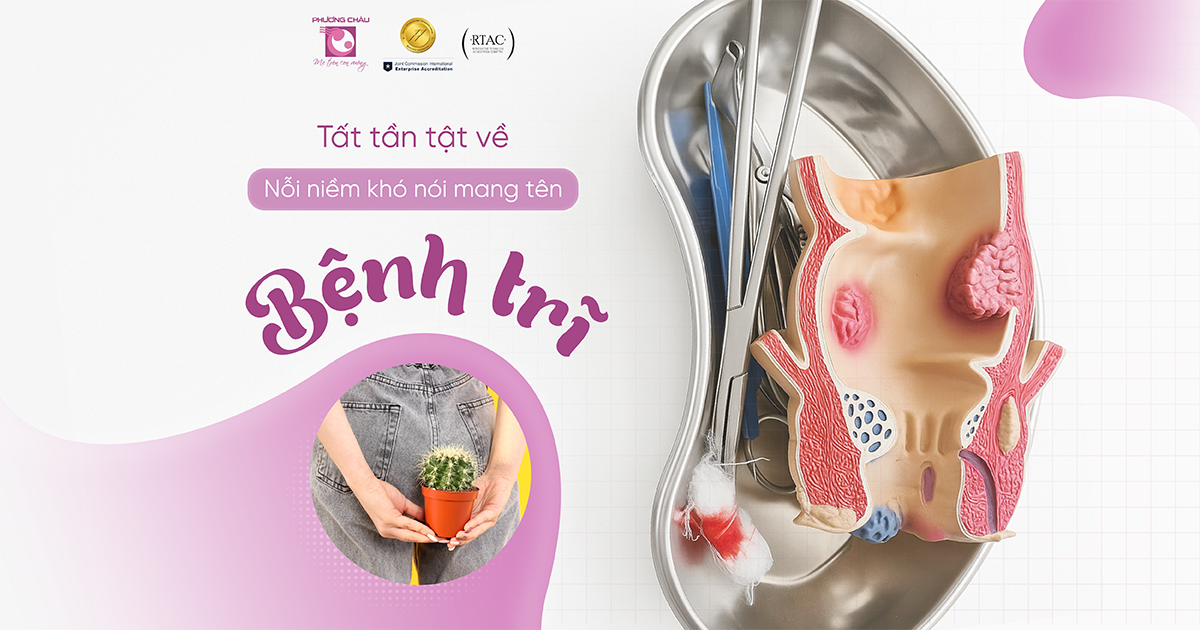 Bệnh trĩ: Nguyên nhân, triệu chứng, phân loại và phương pháp điều trị
