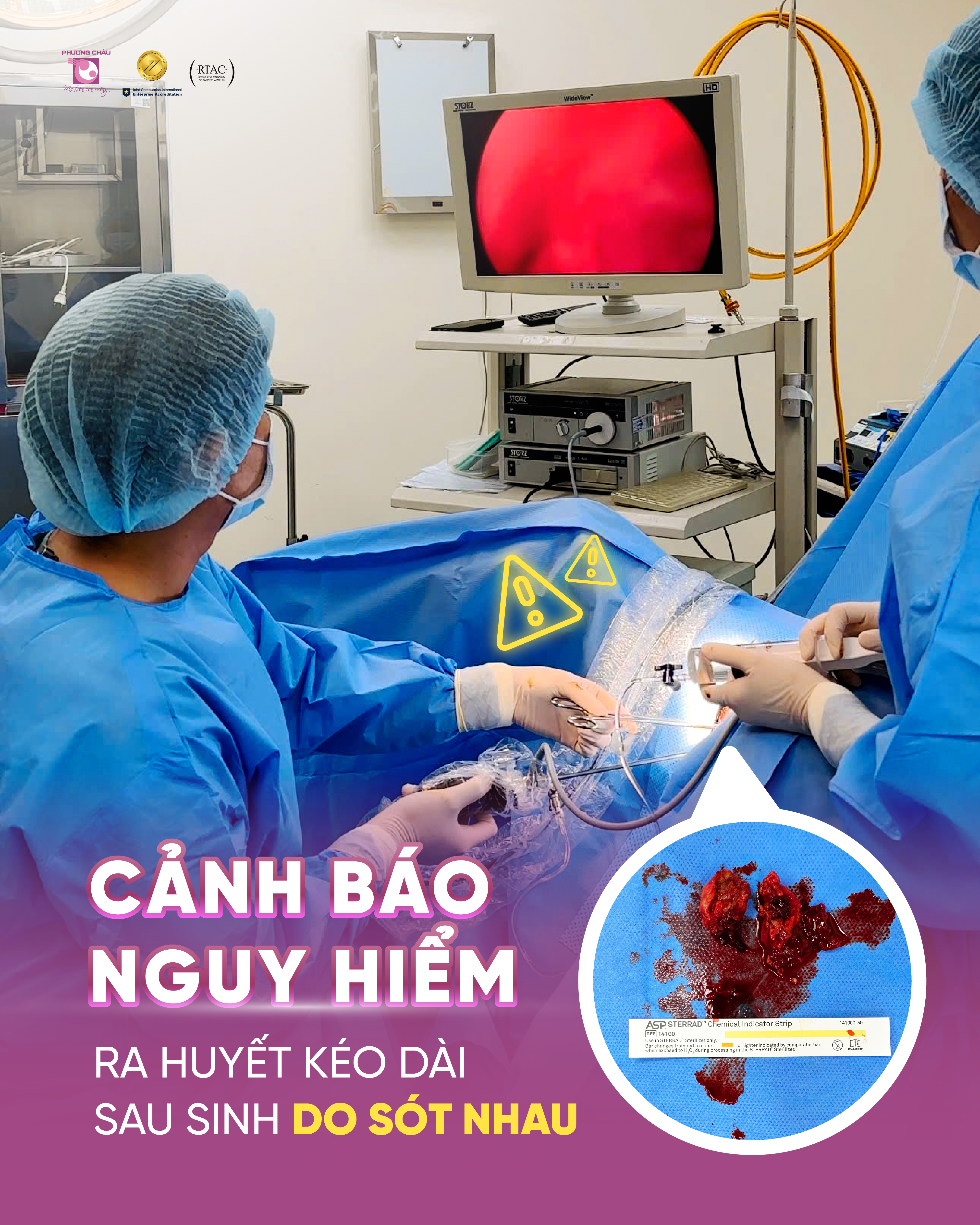 CẢNH BÁO NGUY HIỂM: RA HUYẾT KÉO DÀI SAU SINH DO SÓT NHAU