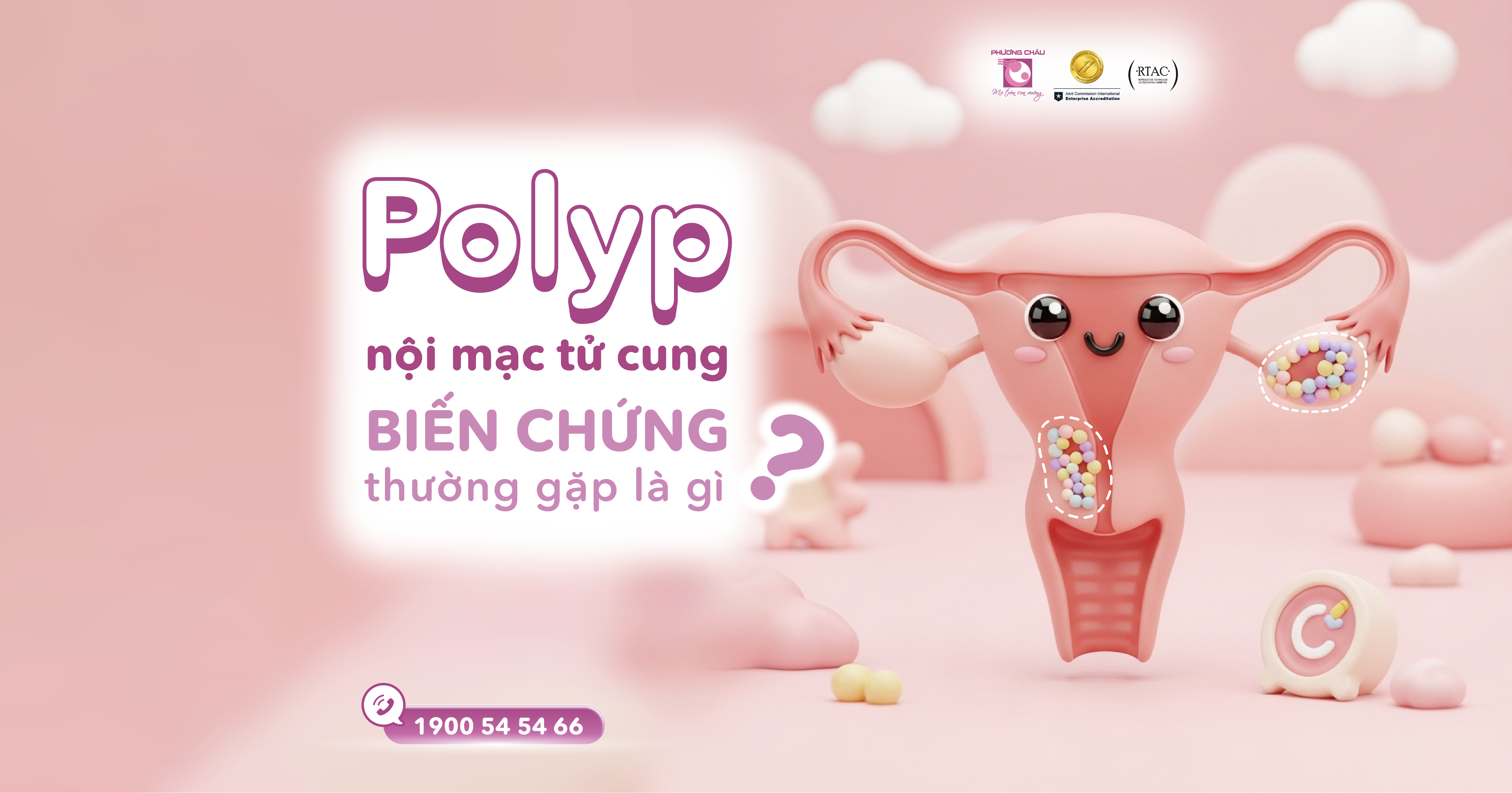 POLYP NỘI MẠC TỬ CUNG