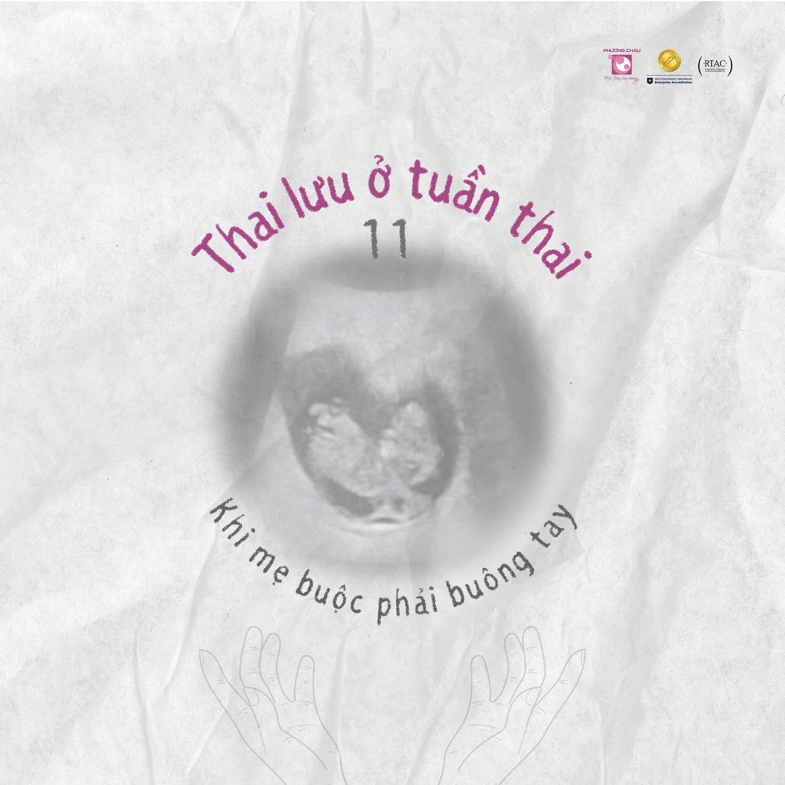 Phát hiện thai lưu ở tuần thai 11 - Khi mẹ buộc phải buông tay