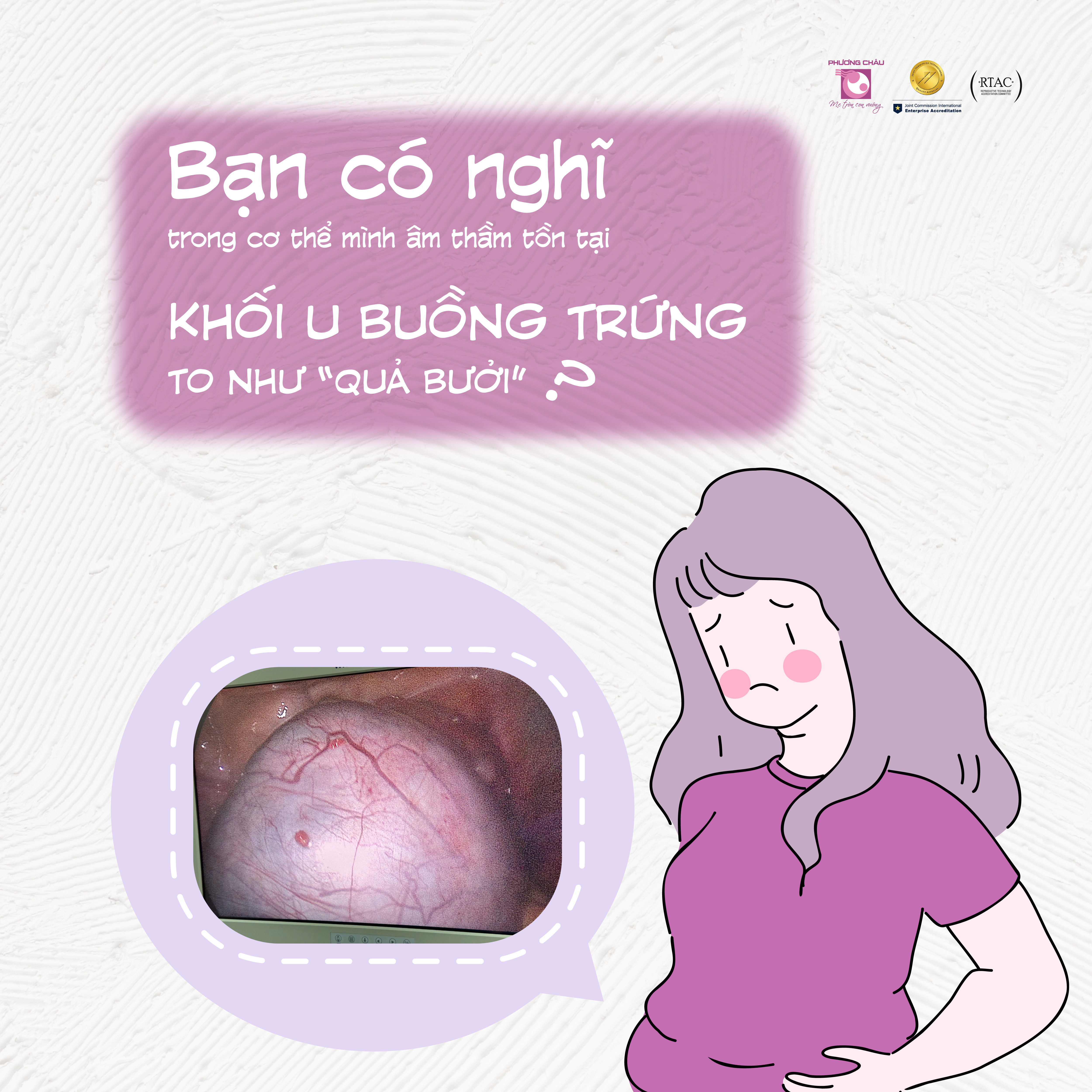 Phát hiện mắc khối u buồng trứng cực to nhờ khám sức khỏe định kỳ