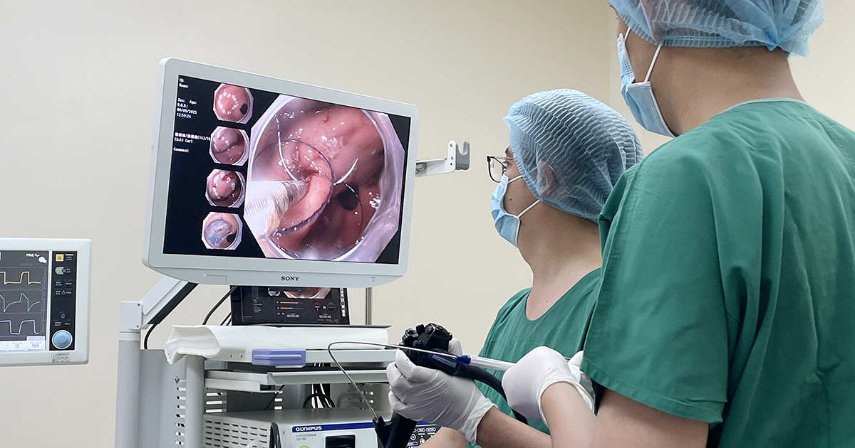 Kỹ thuật hoàn toàn mới: Khâu bằng tay qua nội soi (EHS- Endoscopic Hand-Suturing) sau nội soi điều trị ung thư sớm