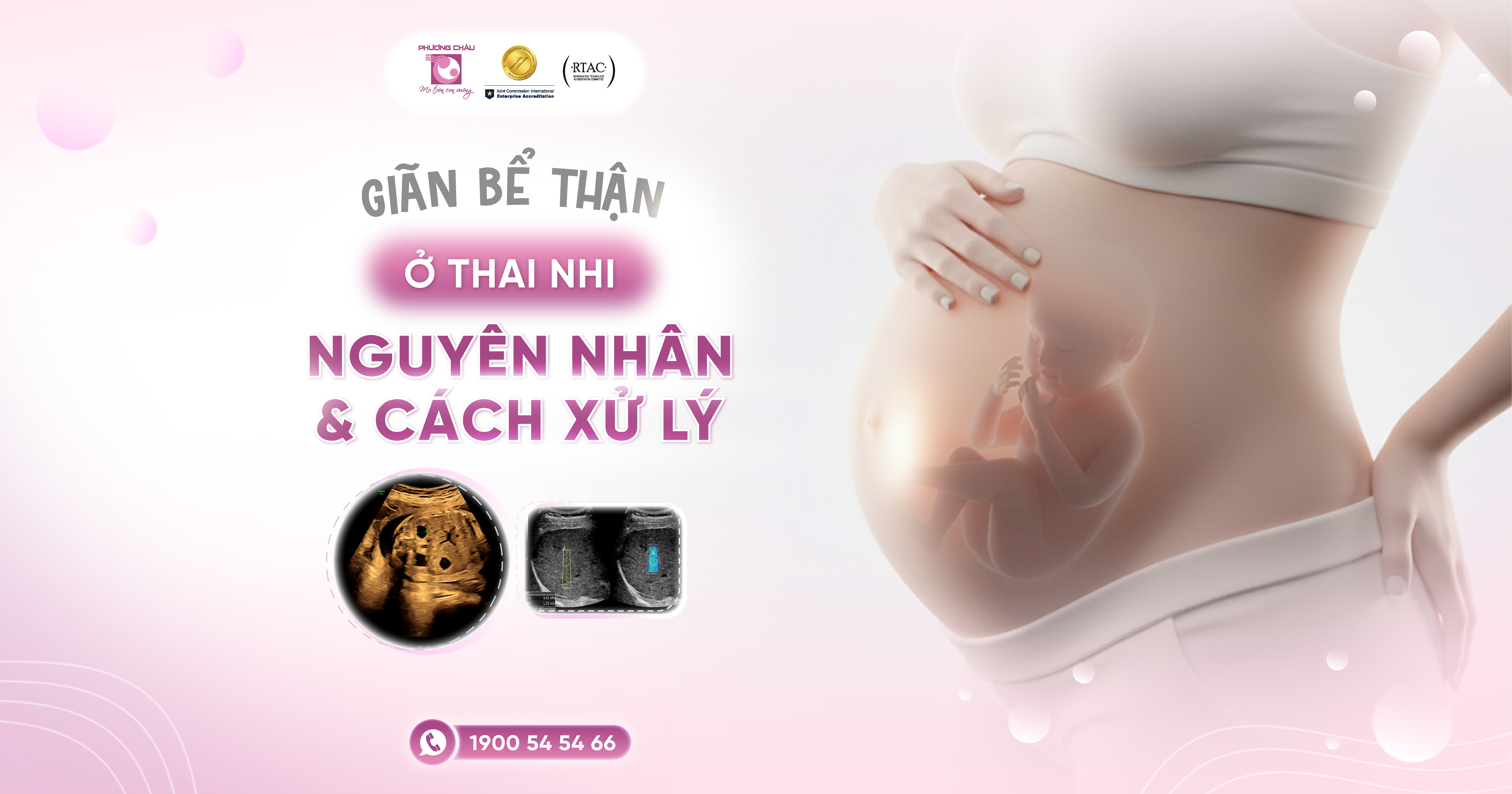 Giãn bể thận ở thai nhi, mẹ bầu cần làm gì?