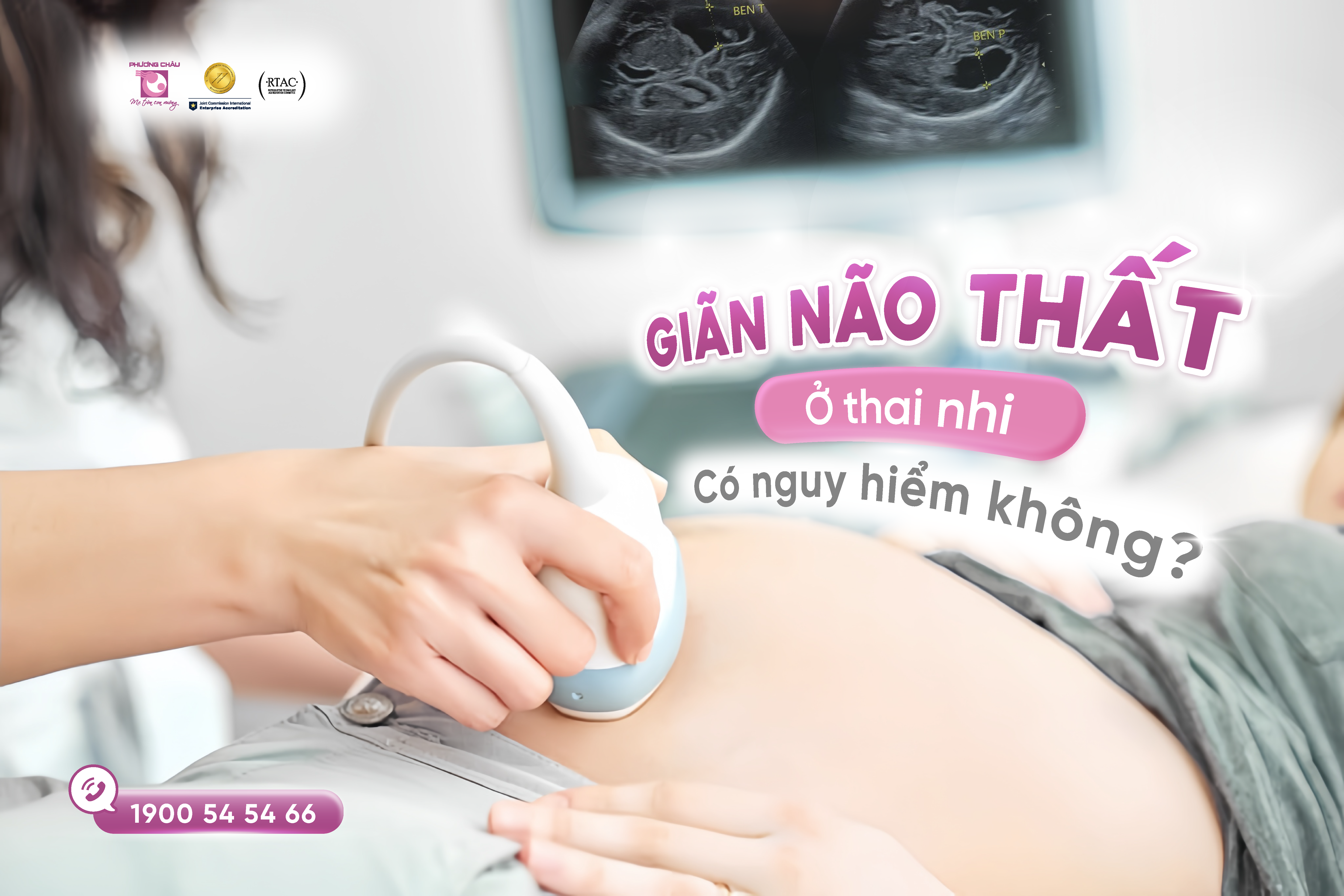 Thai nhi bị giãn não thất - Có nguy hiểm không?