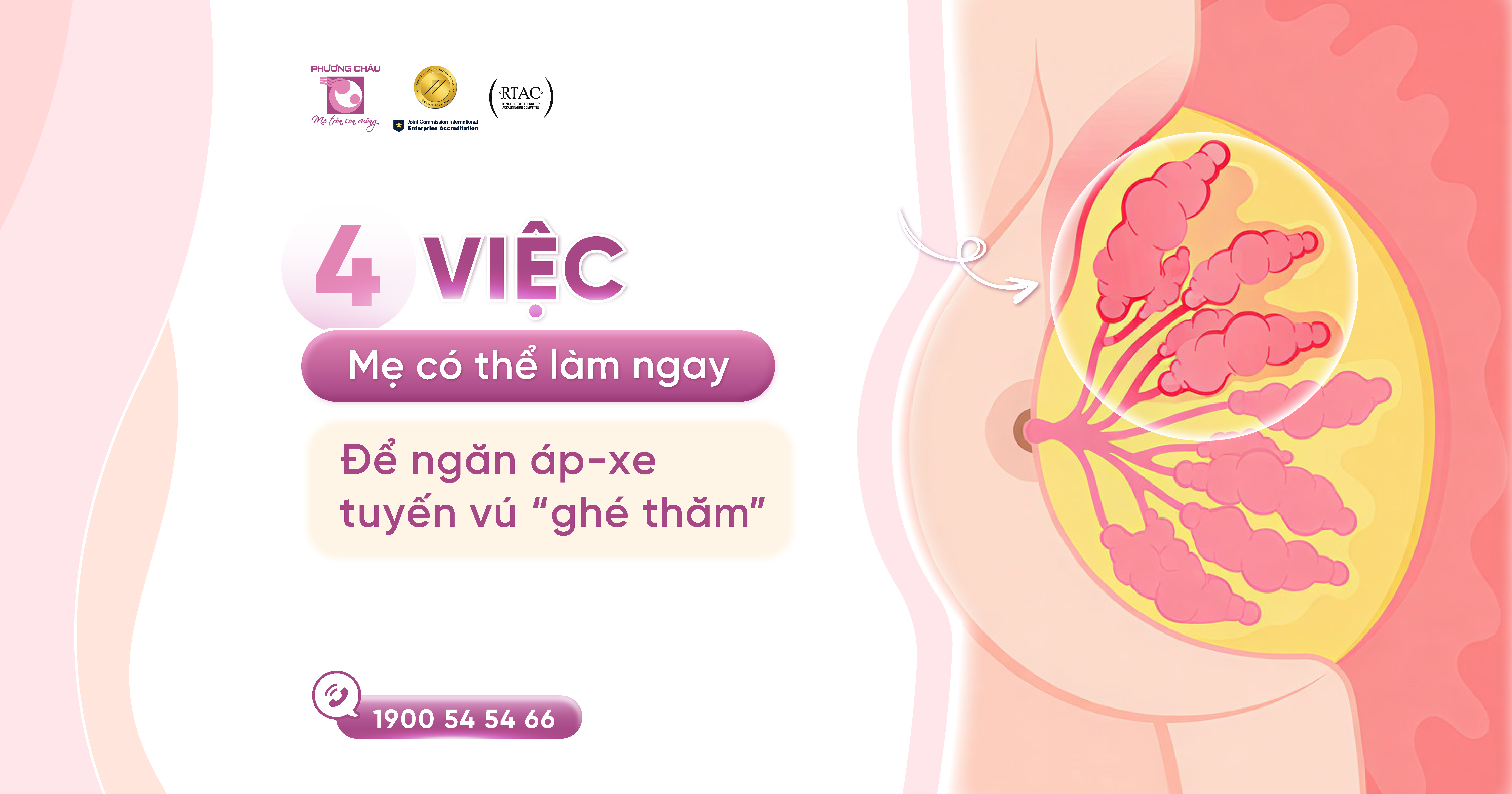 Áp xe tuyến vú sau sinh & Những điều cần lưu ý