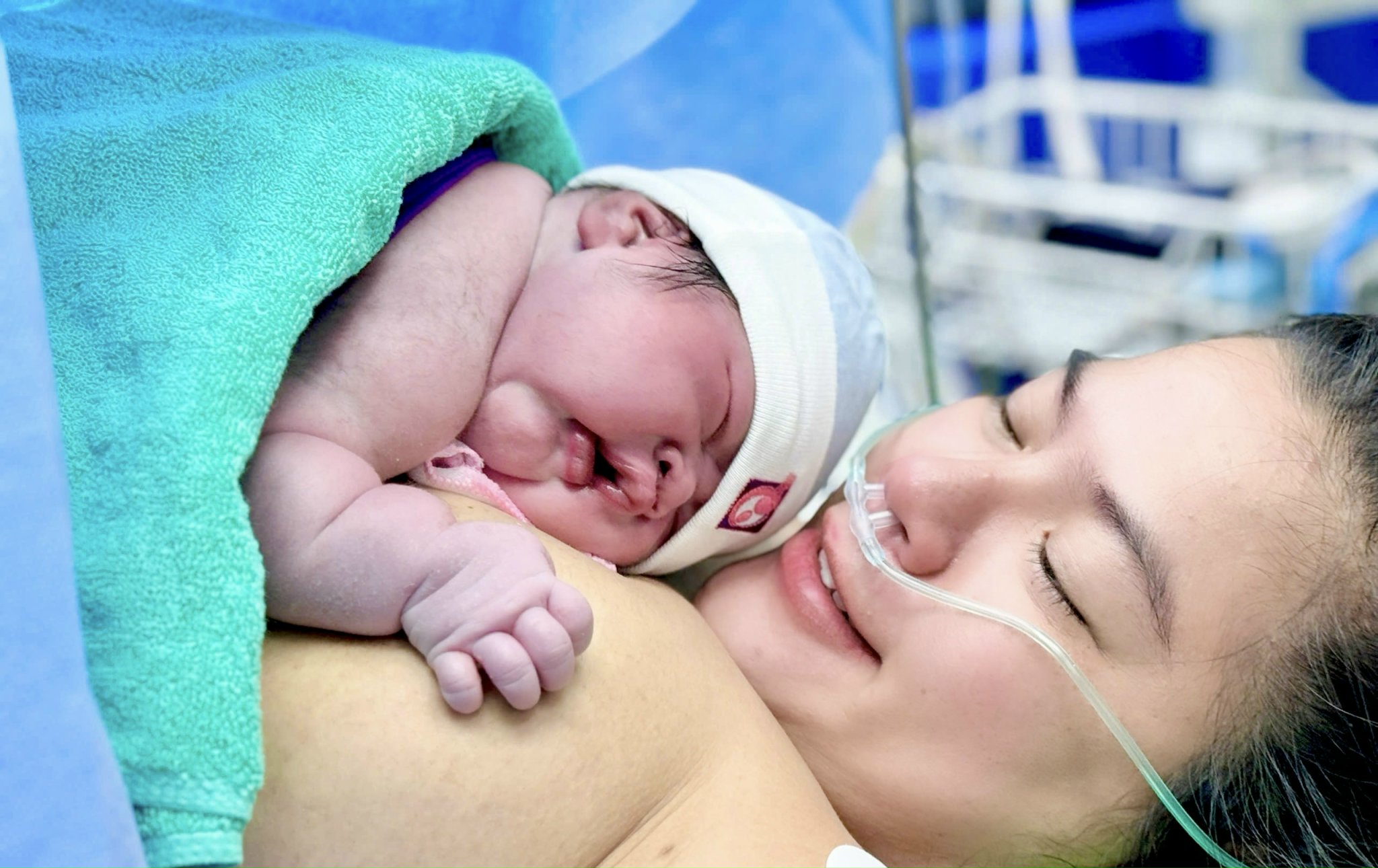 Mẹ bầu thai kỳ nguy cơ cao vượt cạn thành công nhờ sự đồng hành đa chuyên khoa