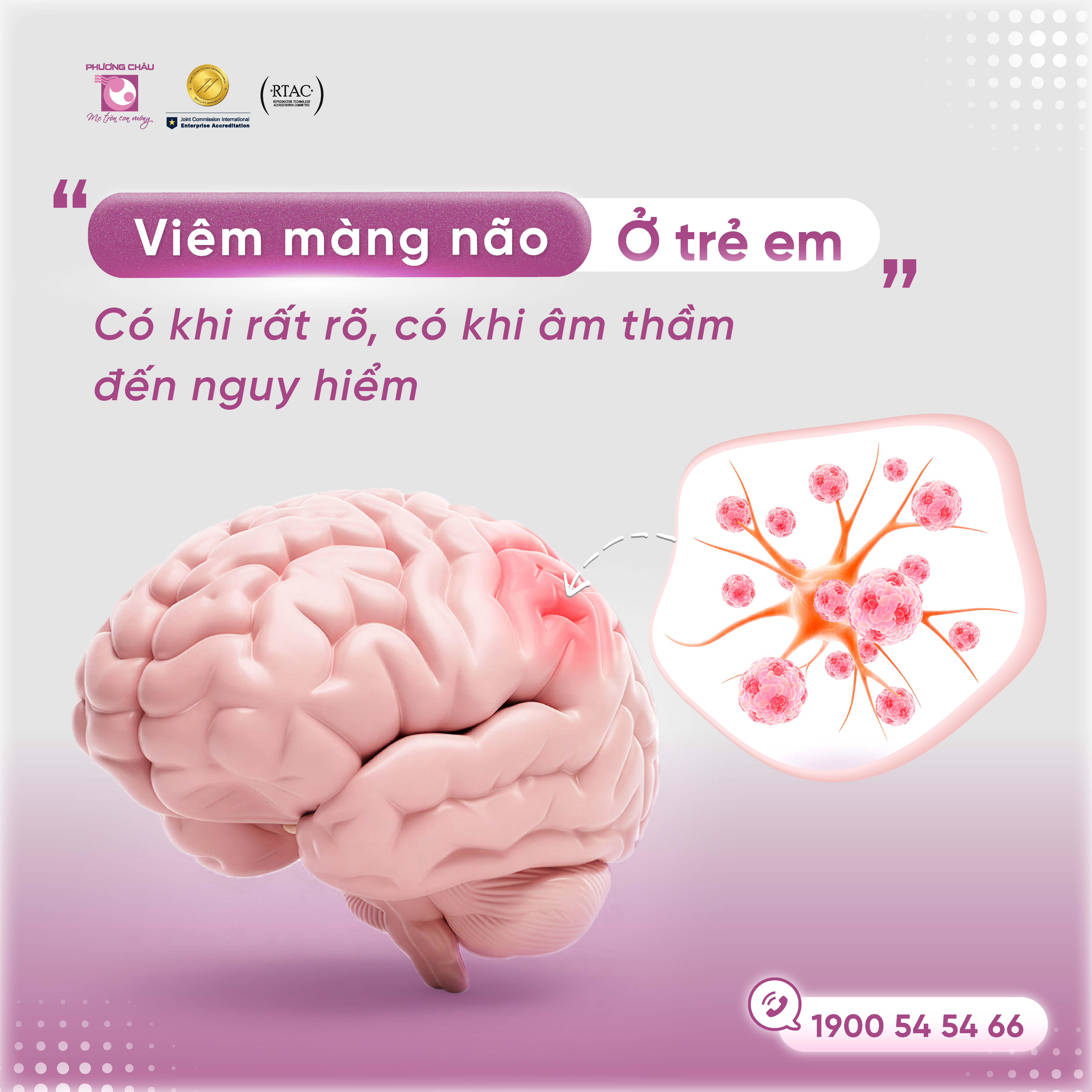 Viêm màng não ở trẻ em và những điều cần lưu ý