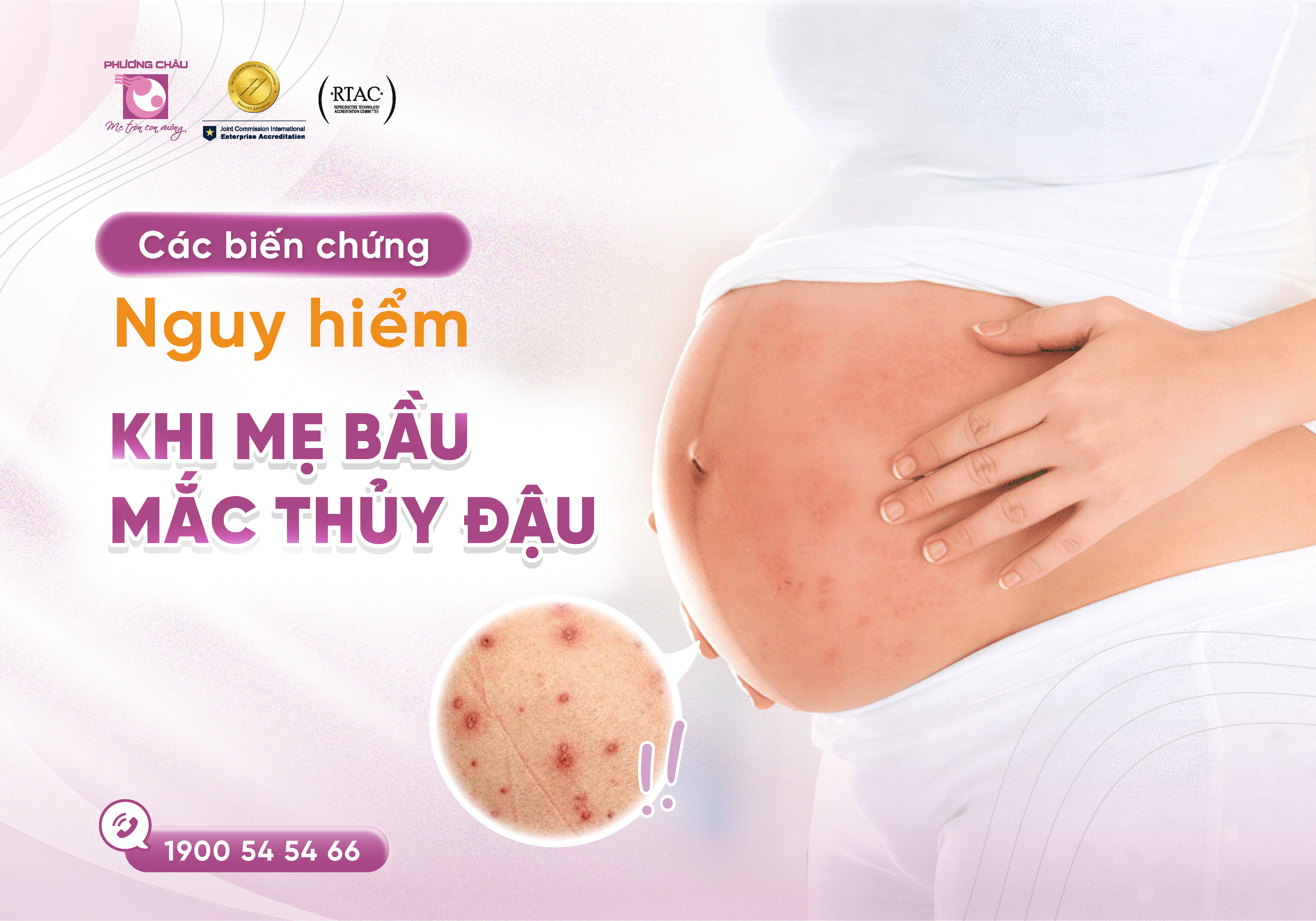 Mẹ bầu mắc giang mai ảnh hưởng như thế nào đến thai nhi?