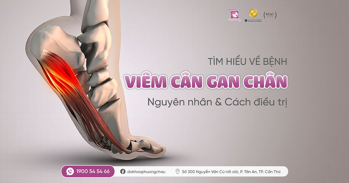 Viêm cân gan chân: Nguyên nhân, triệu chứng và cách điều trị
