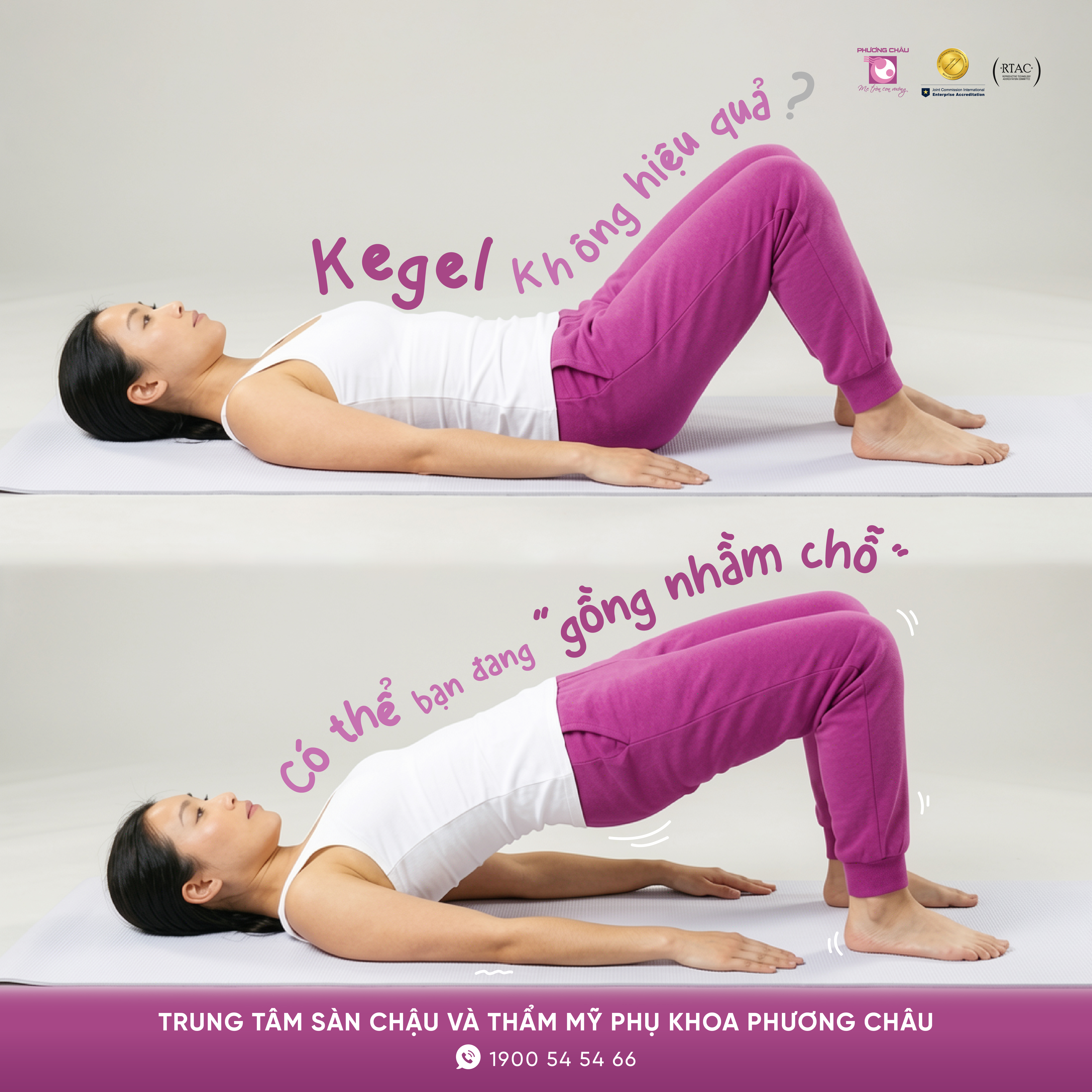 Tập kegel tại nhà có hiệu quả không?