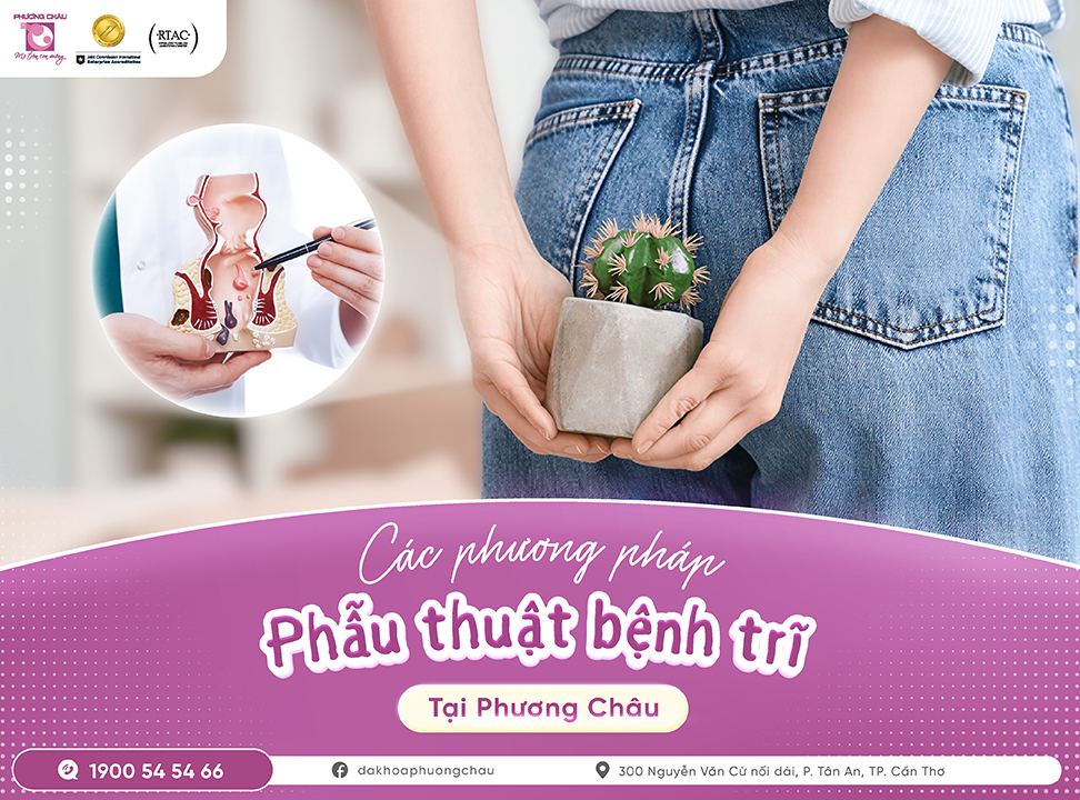Các phương pháp phẫu thuật bệnh trĩ tại Phương Châu