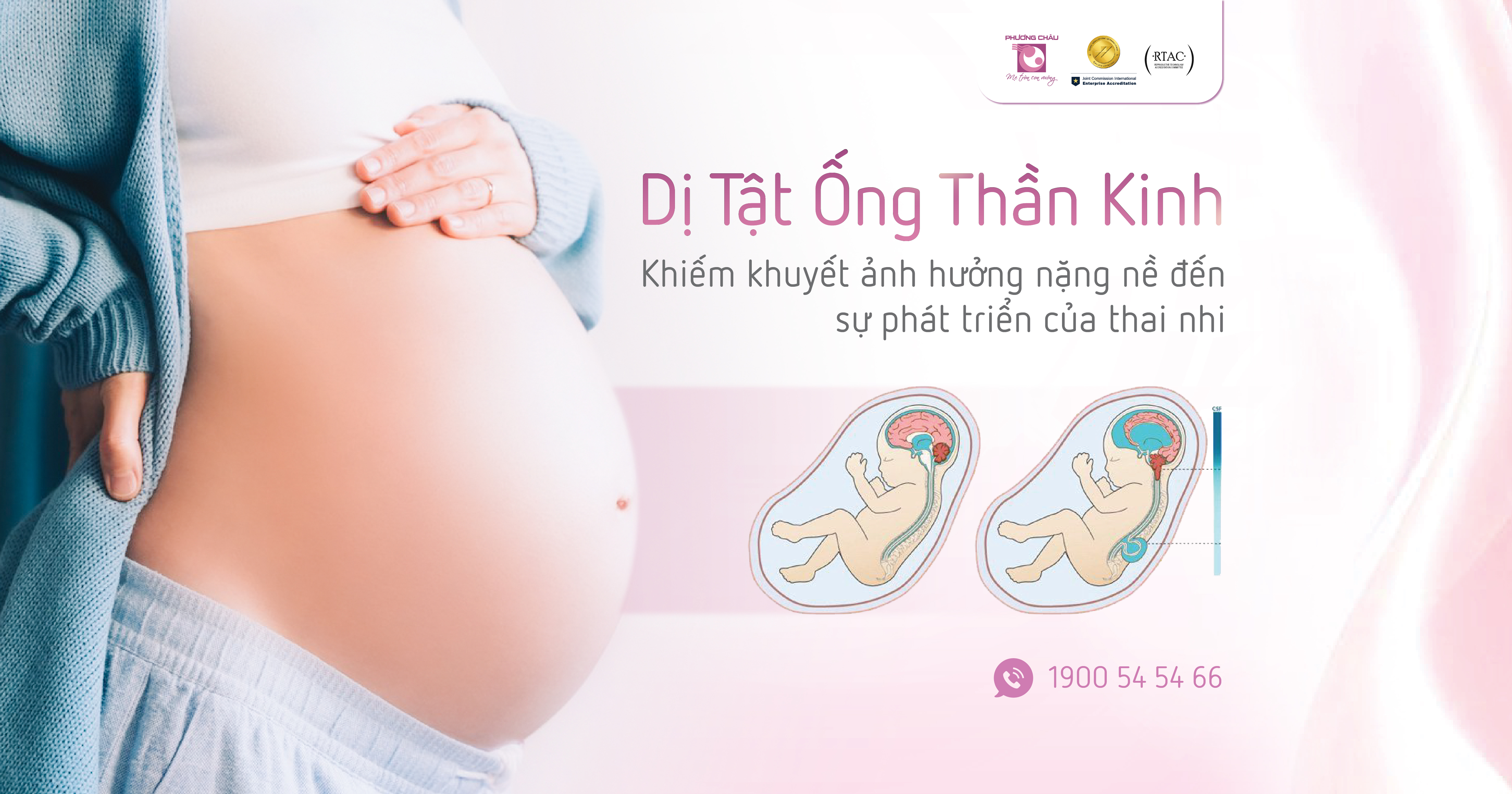 Dị tật ống thần kinh - Khiếm khuyết hiếm gặp và những ảnh hưởng nặng nề đến thai nhi