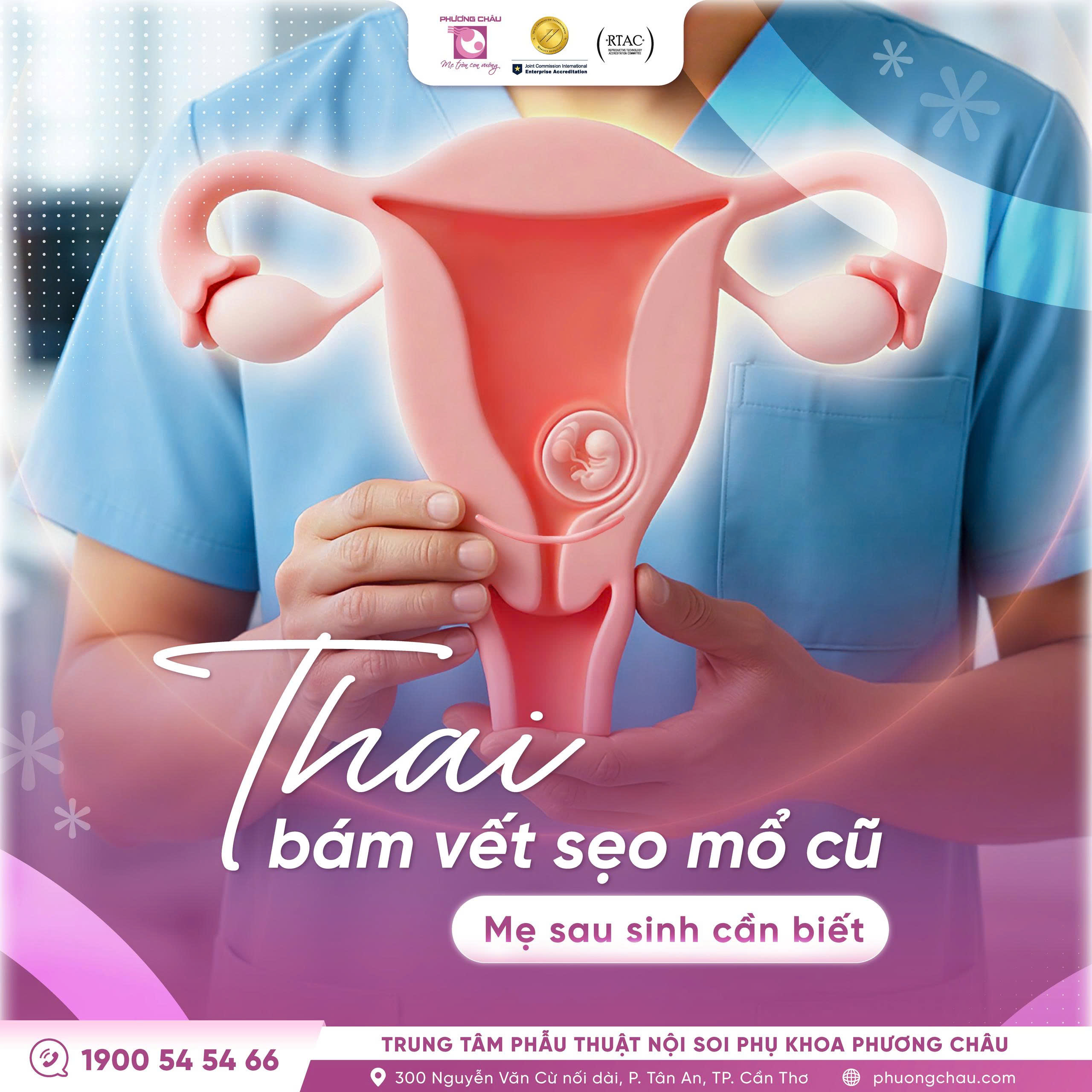 Thai bám vết sẹo mổ cũ và những điều cần lưu ý