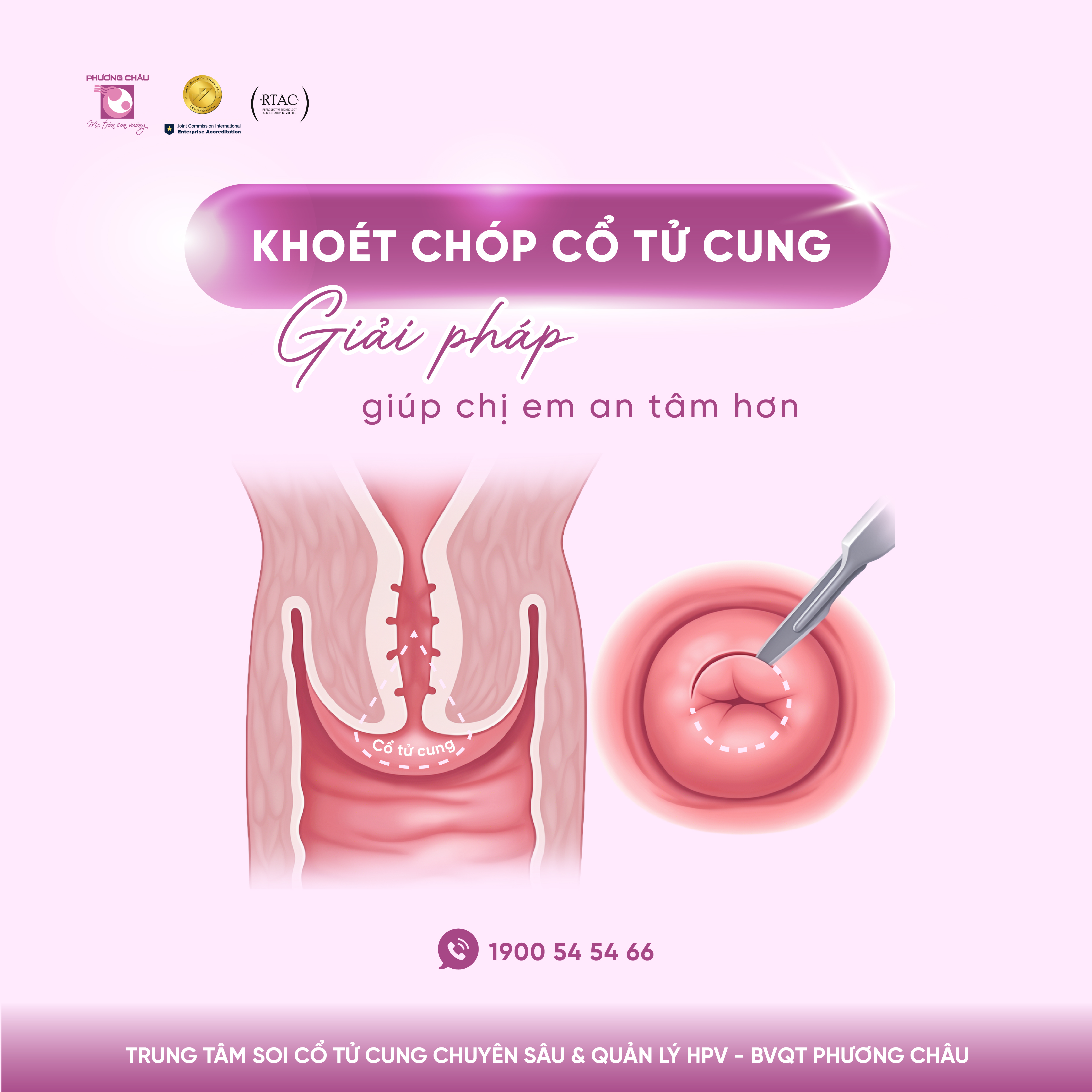 Khoét chóp cổ tử cung có nguy hiểm không?